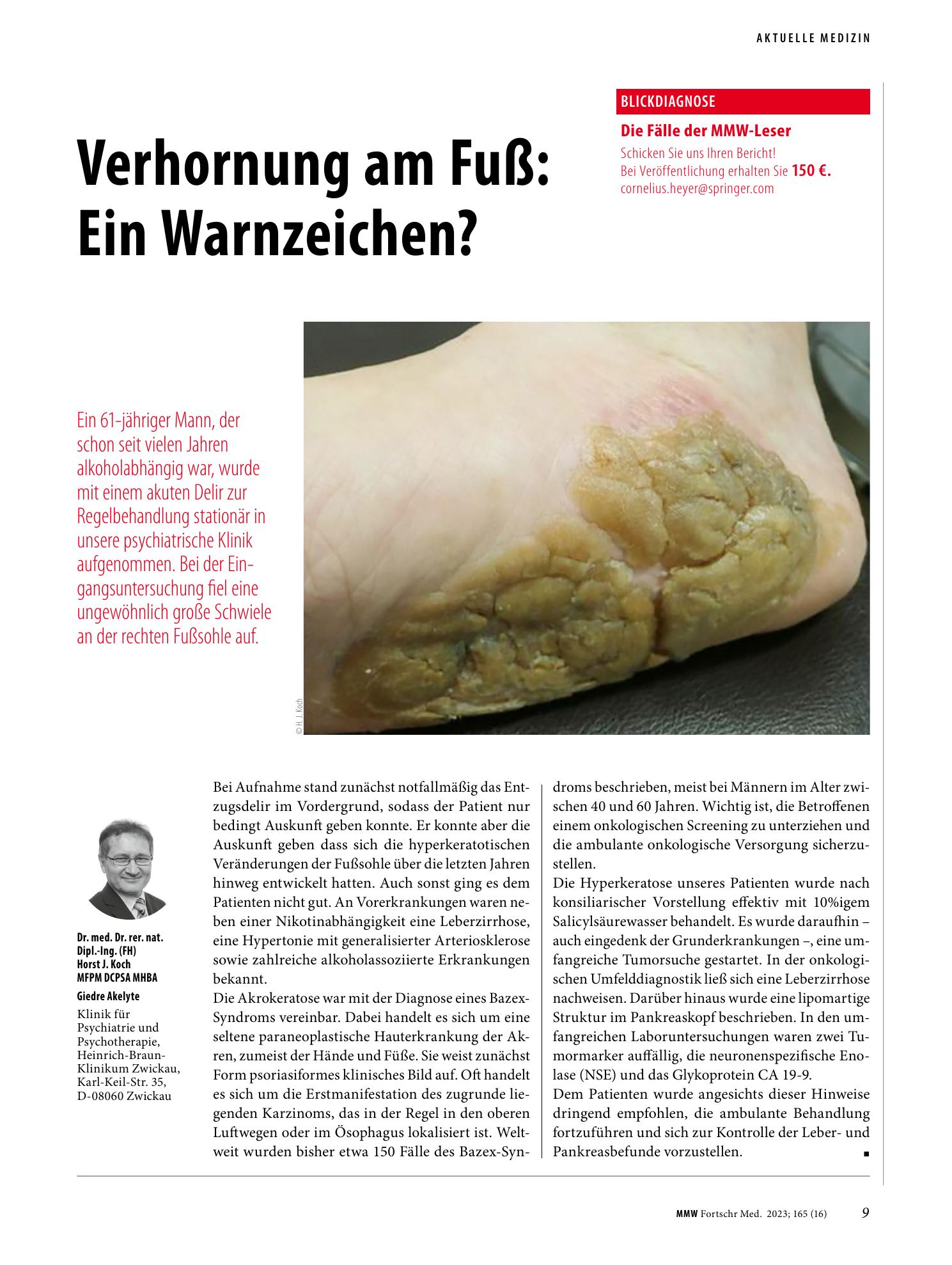 Vorschauseite 1: Verhornung am Fuß: Ein Warnzeichen?