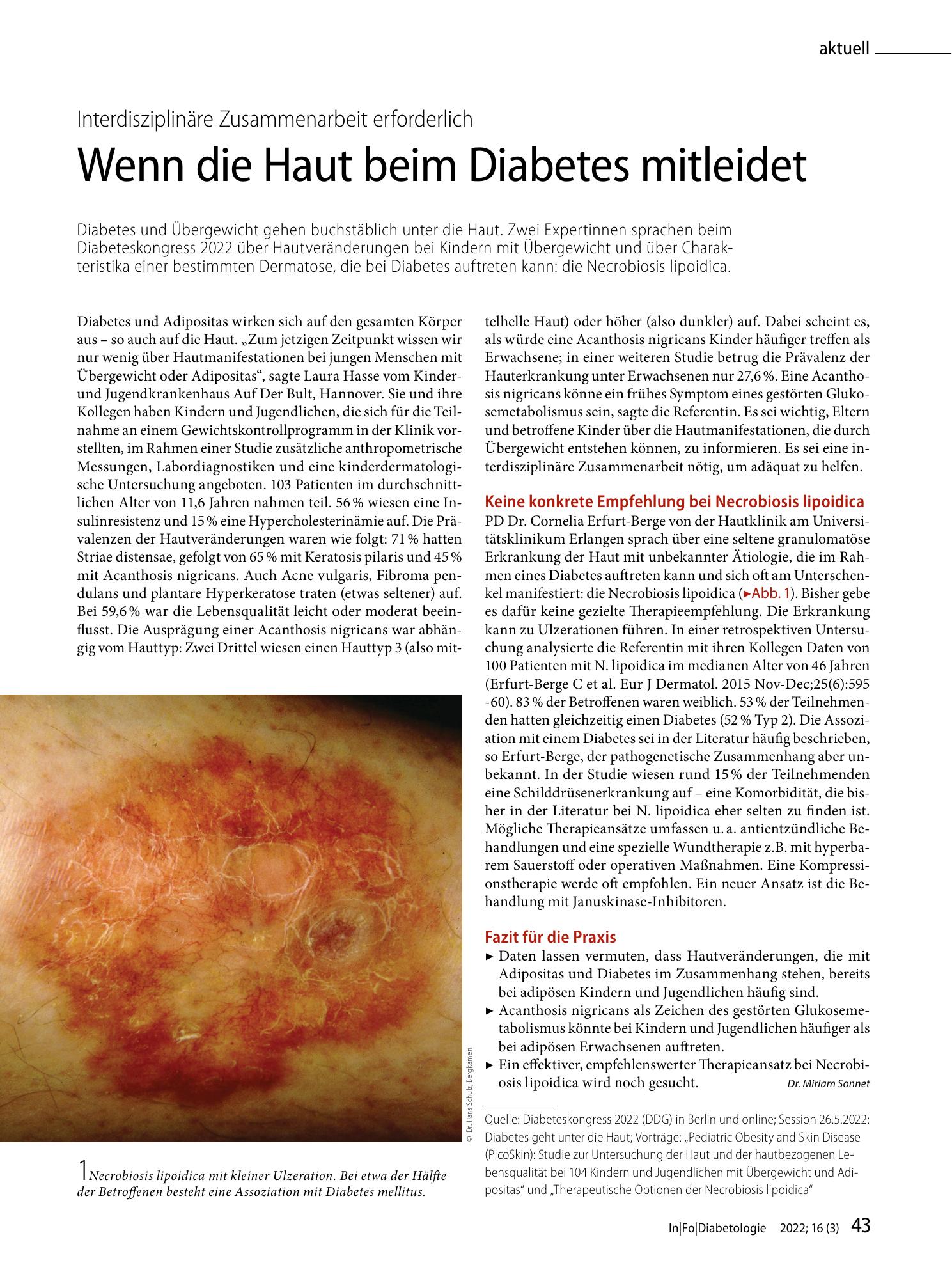 Vorschauseite 1: Wenn die Haut beim Diabetes mitleidet