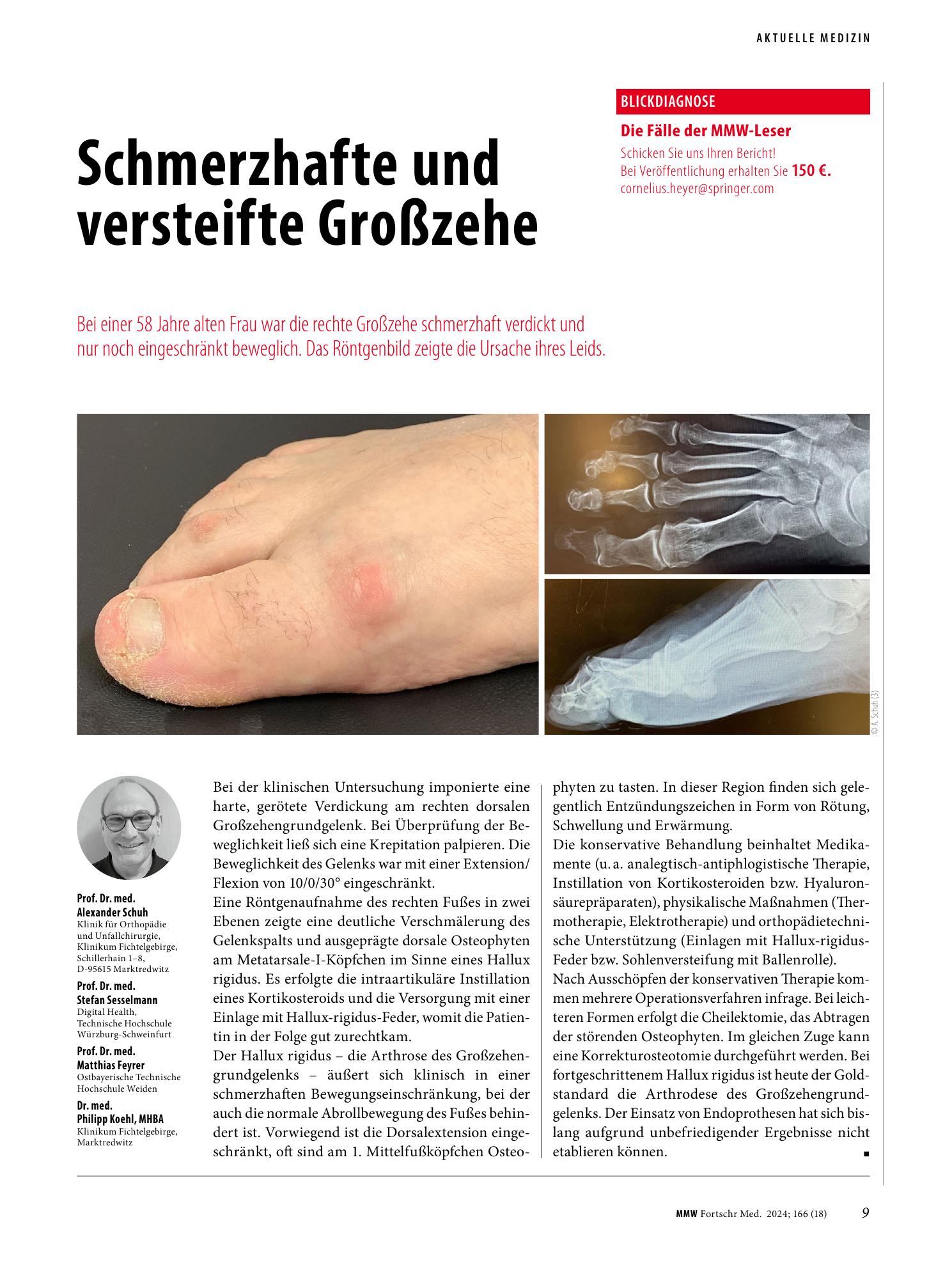 Vorschauseite 1: Hallux rigidus