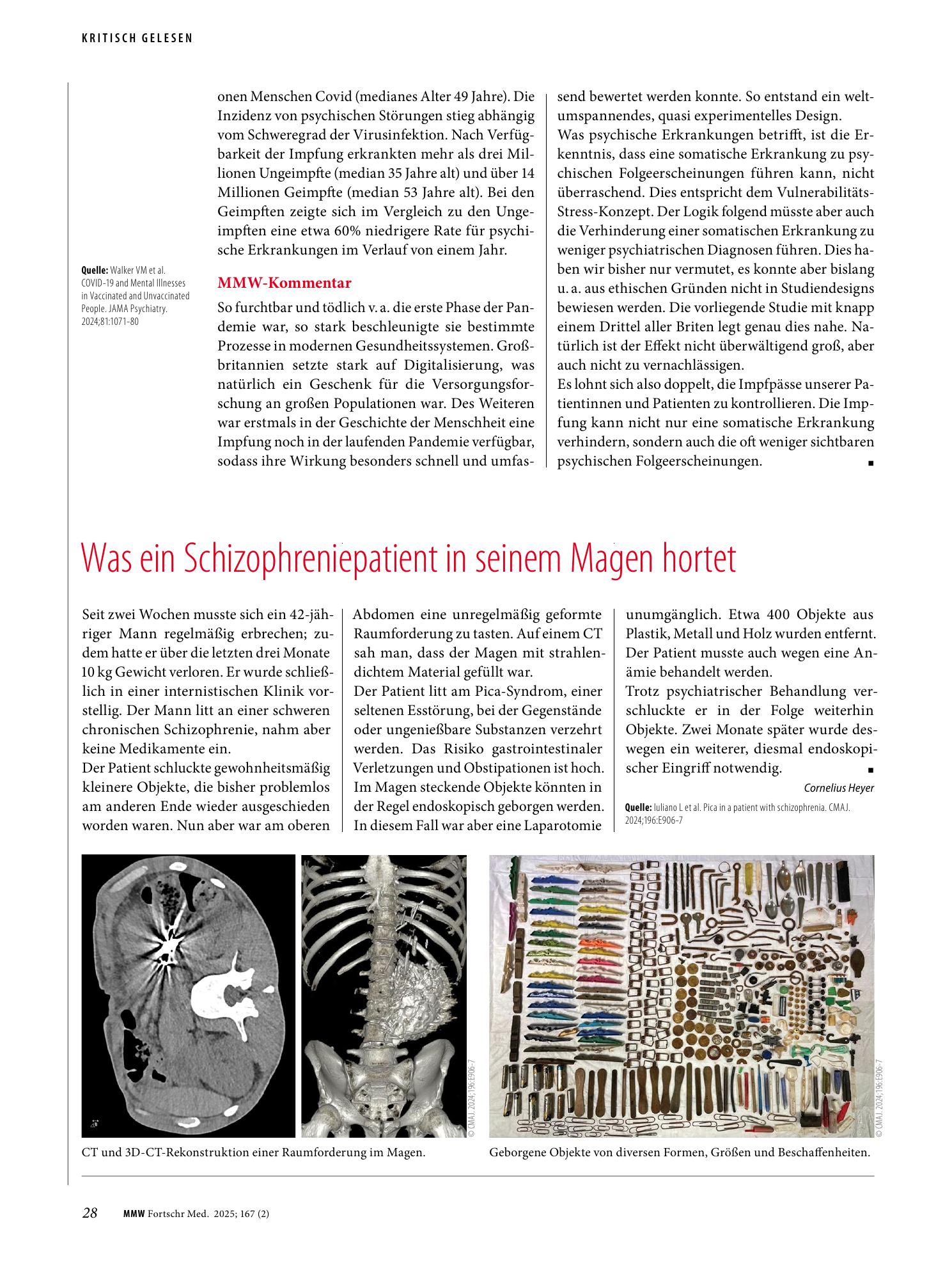 Vorschauseite 1: Was ein Schizophreniepatient in seinem Magen hortet