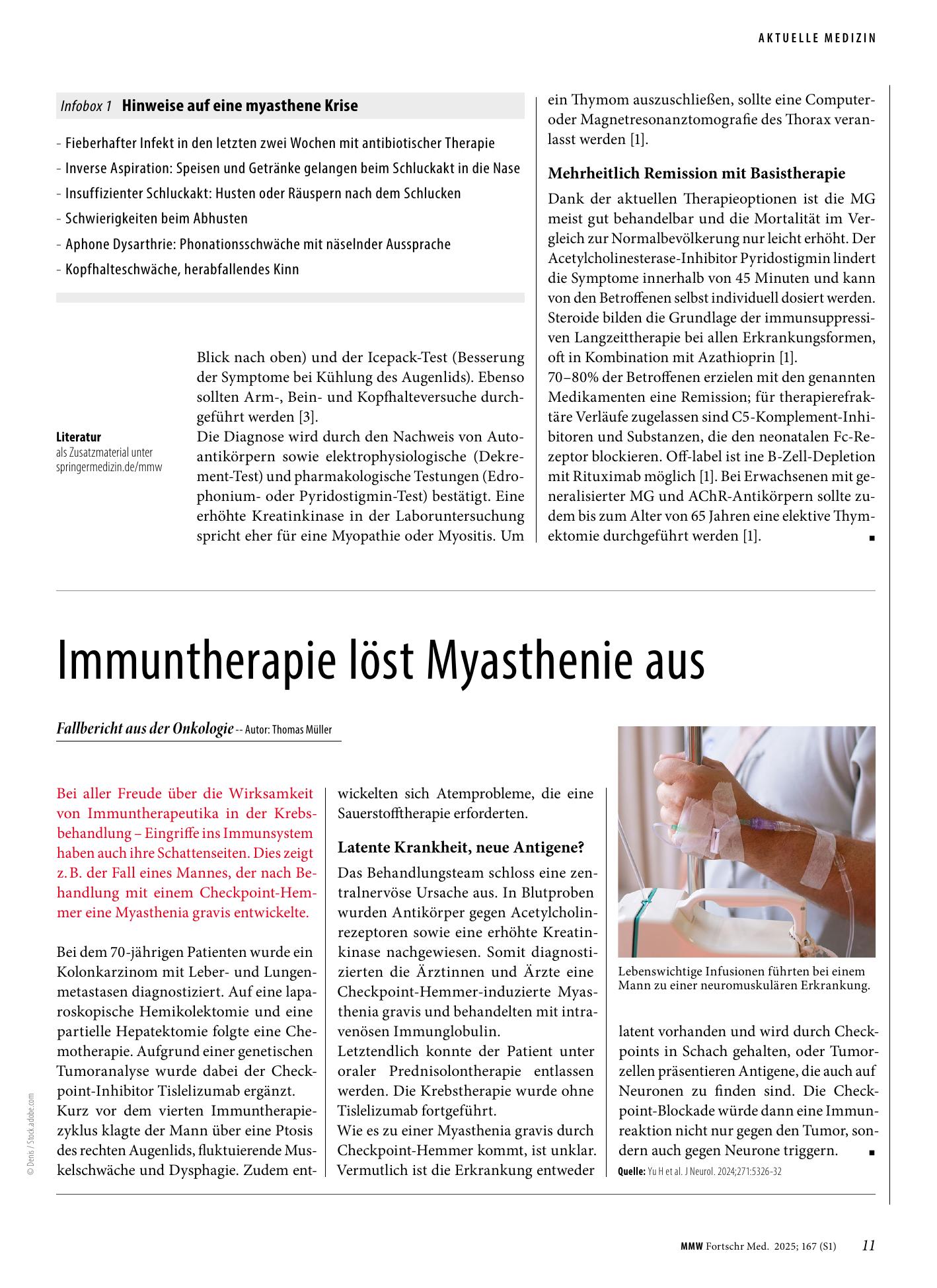 Vorschauseite 1: Immuntherapie löst Myasthenie aus