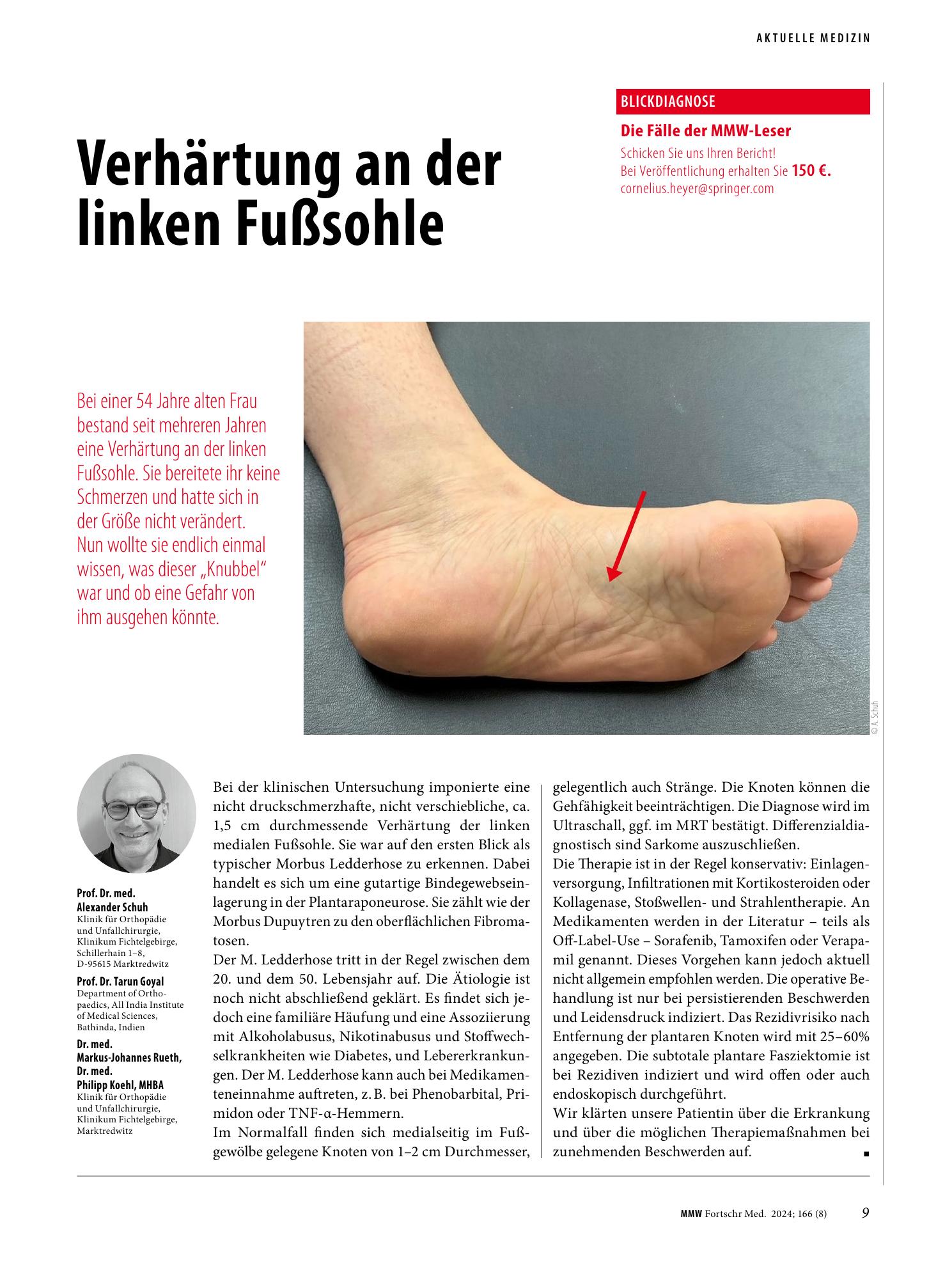 Vorschauseite 1: Verhärtung an der linken Fußsohle