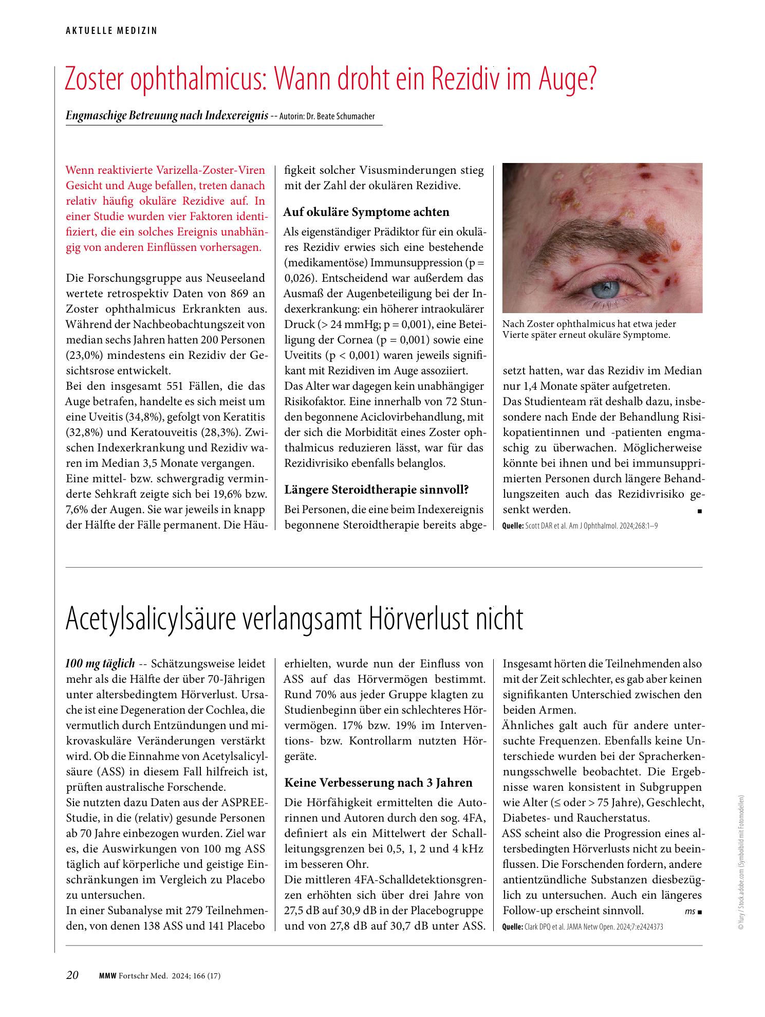 Vorschauseite 1: Zoster ophthalmicus: Wann droht ein Rezidiv im Auge?
