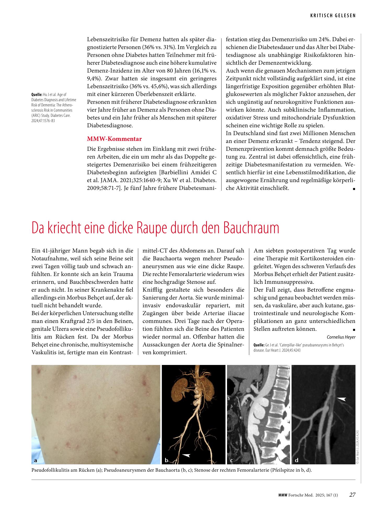 Vorschauseite 1: Da kriecht eine dicke Raupe durch den Bauchraum