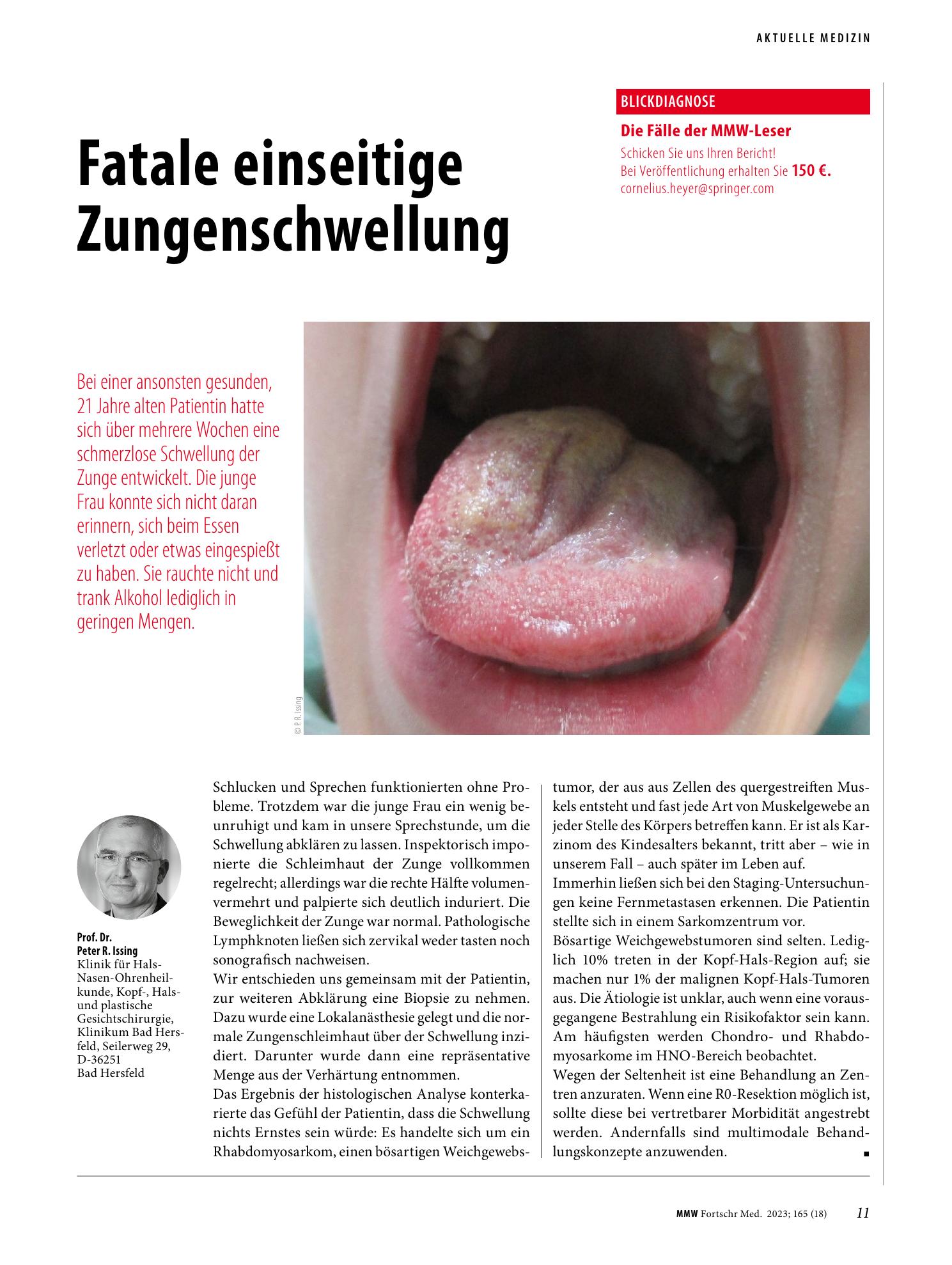 Vorschauseite 1: Fatale einseitige Zungenschwellung