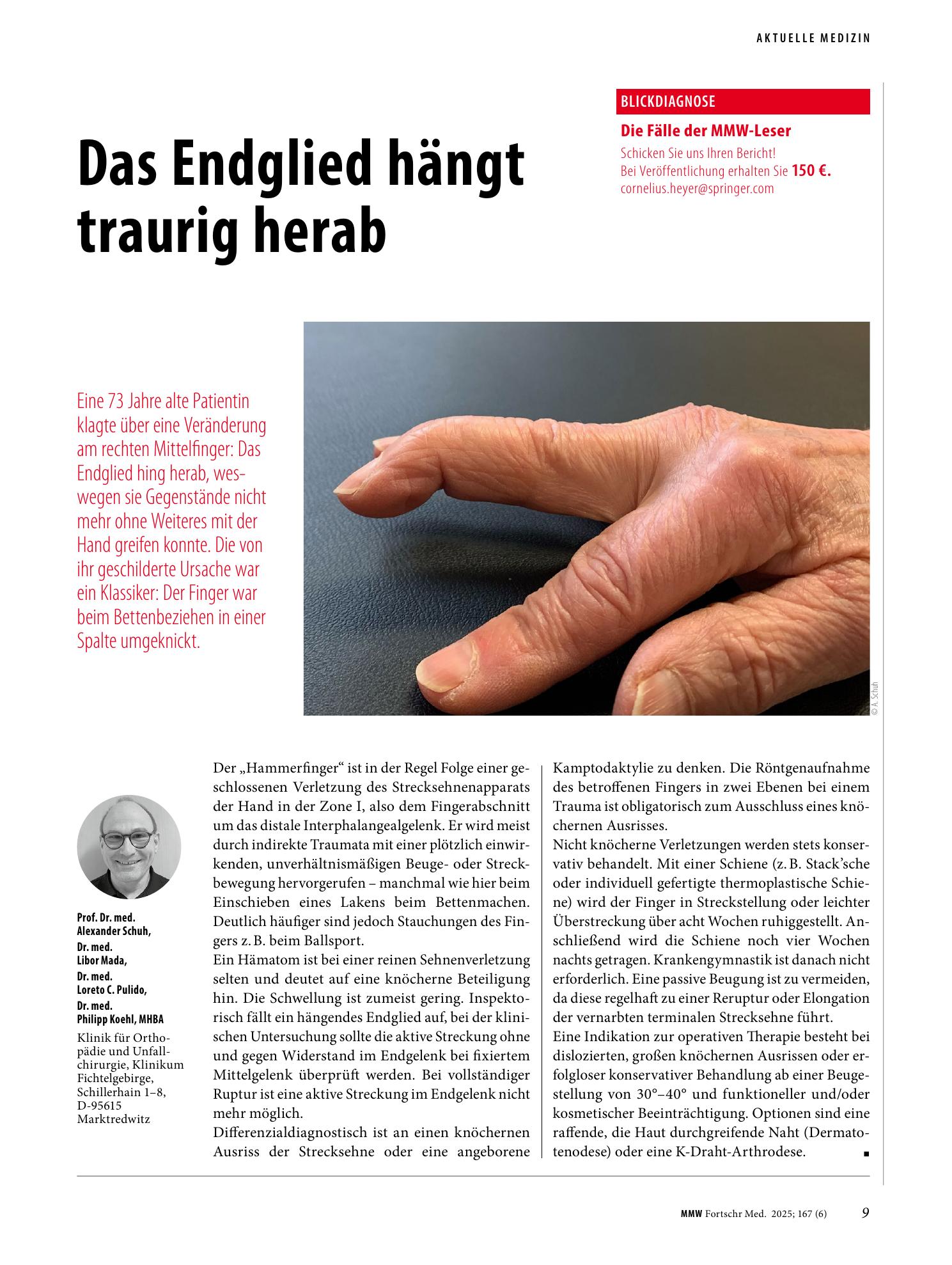Vorschauseite 1: Das Endglied hängt traurig herab