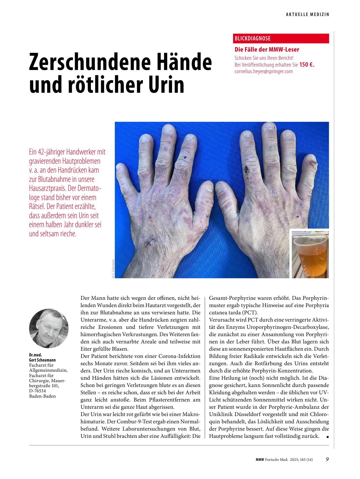 Vorschauseite 1: Zerschundene Hände und rötlicher Urin