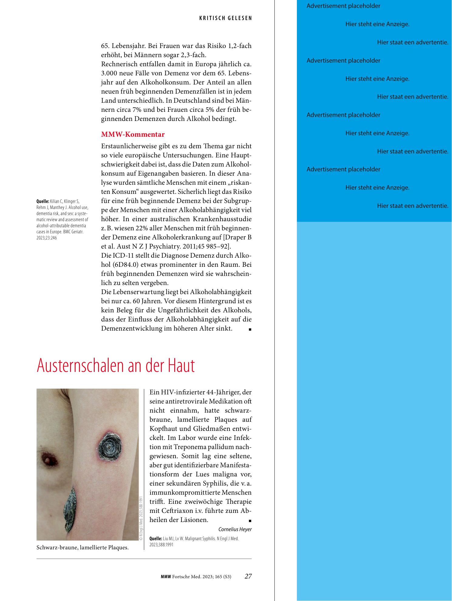 Vorschauseite 1: Austernschalen an der Haut