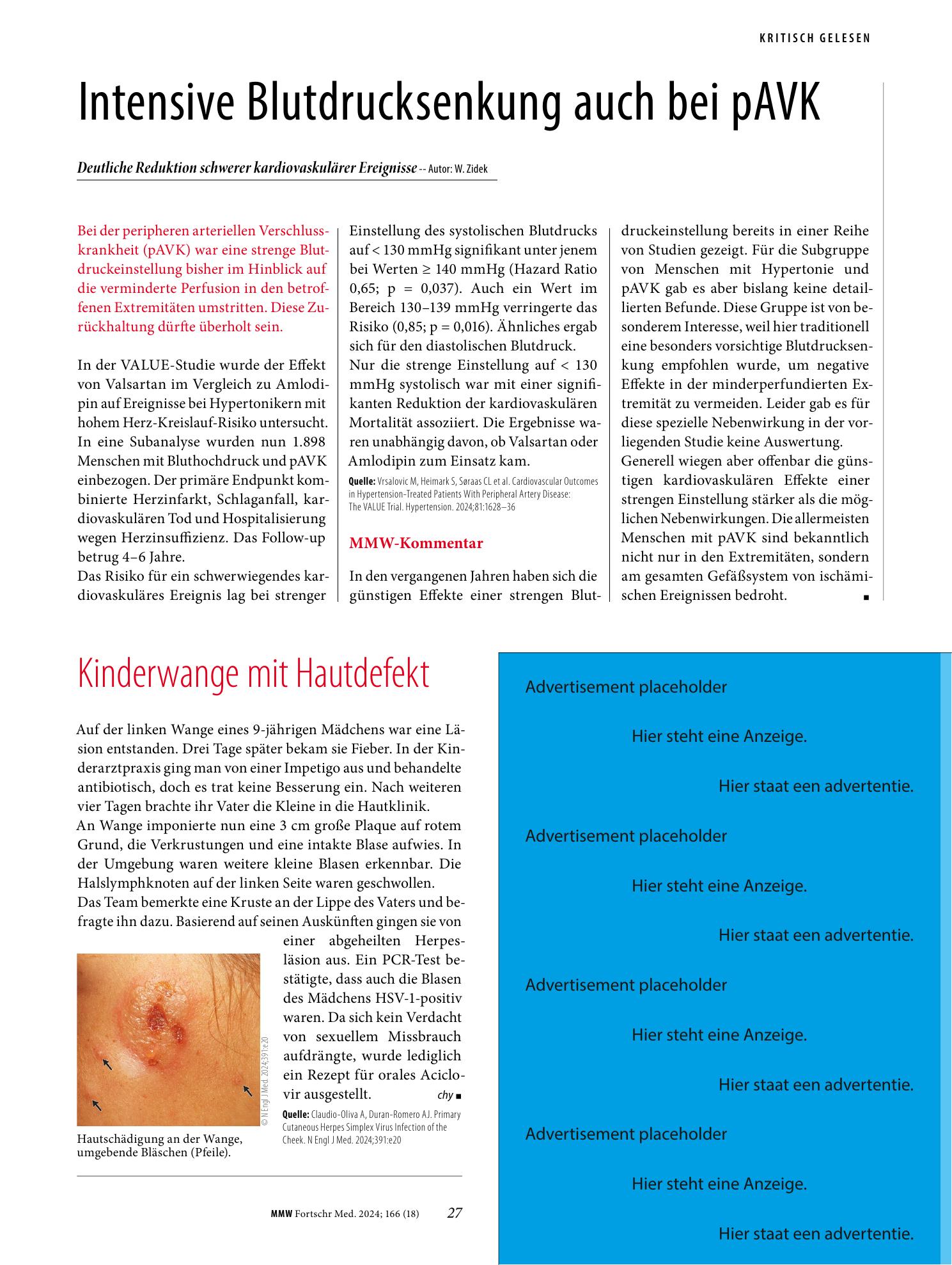 Vorschauseite 1: Kinderwange mit Hautdefekt