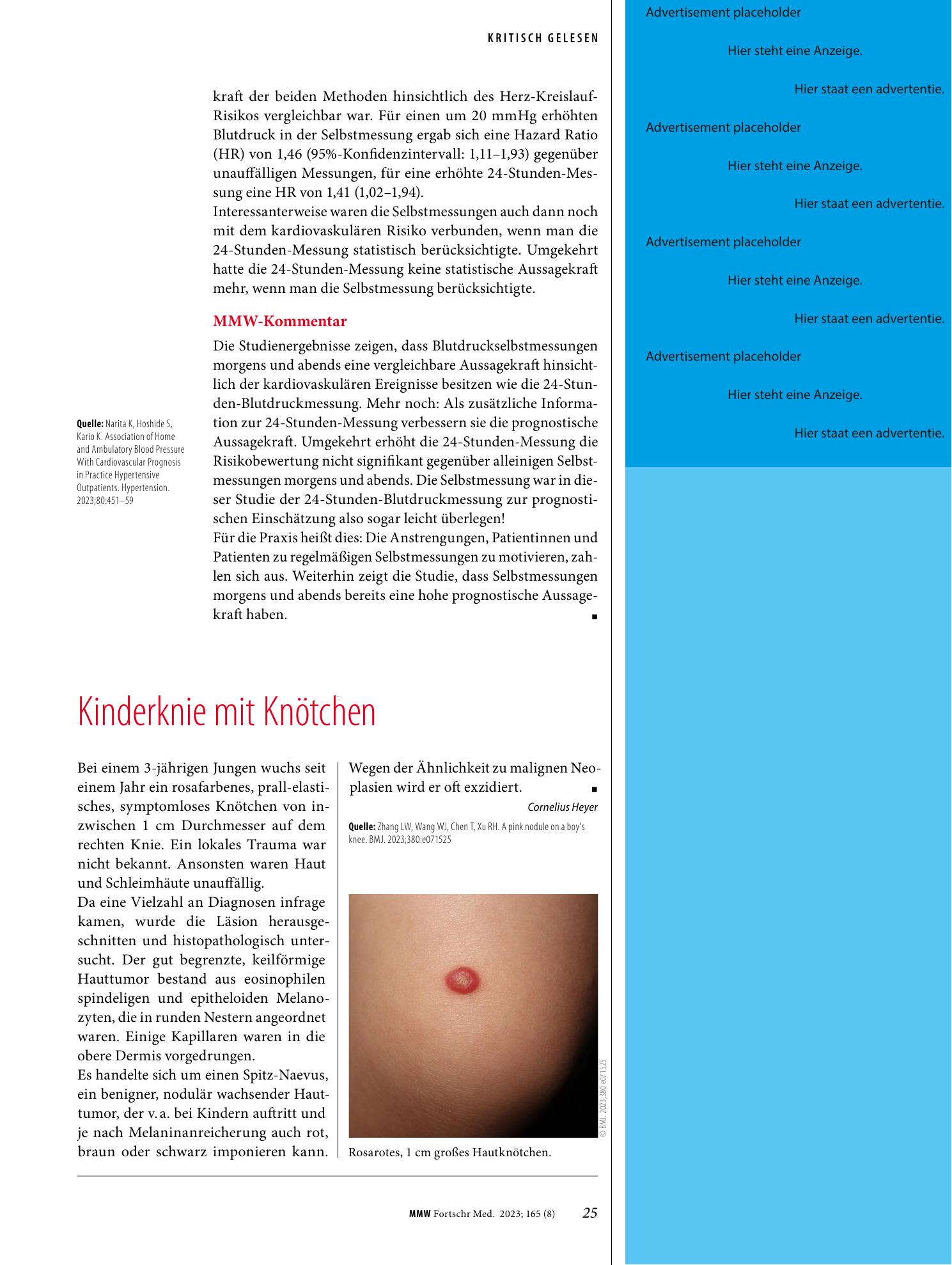 Vorschauseite 1: Kinderknie mit Knötchen
