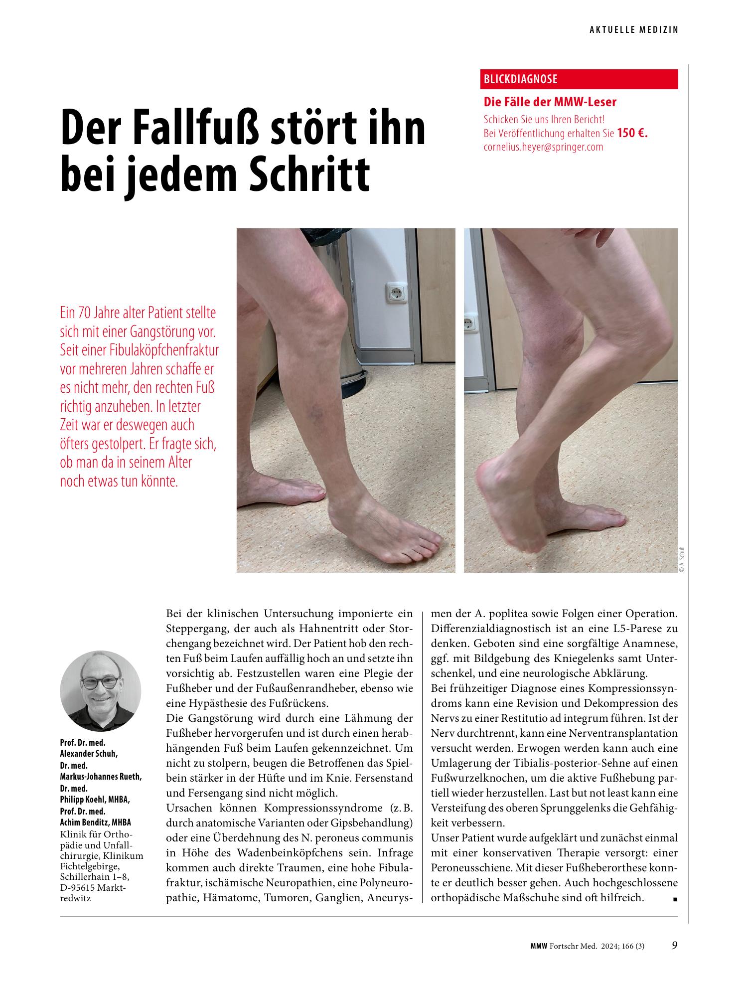 Vorschauseite 1: Drop-foot gait