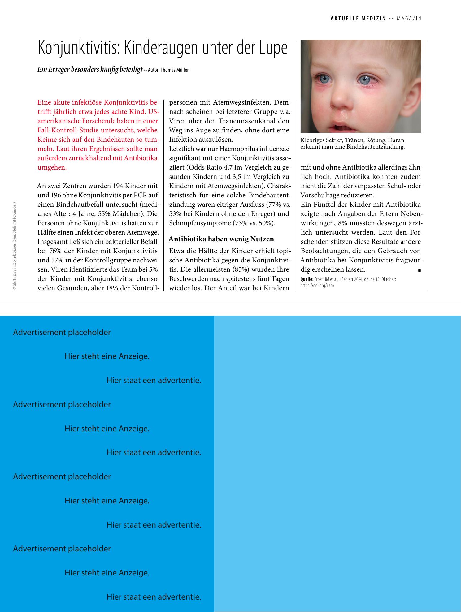Vorschauseite 1: Konjunktivitis: Kinderaugen unter der Lupe