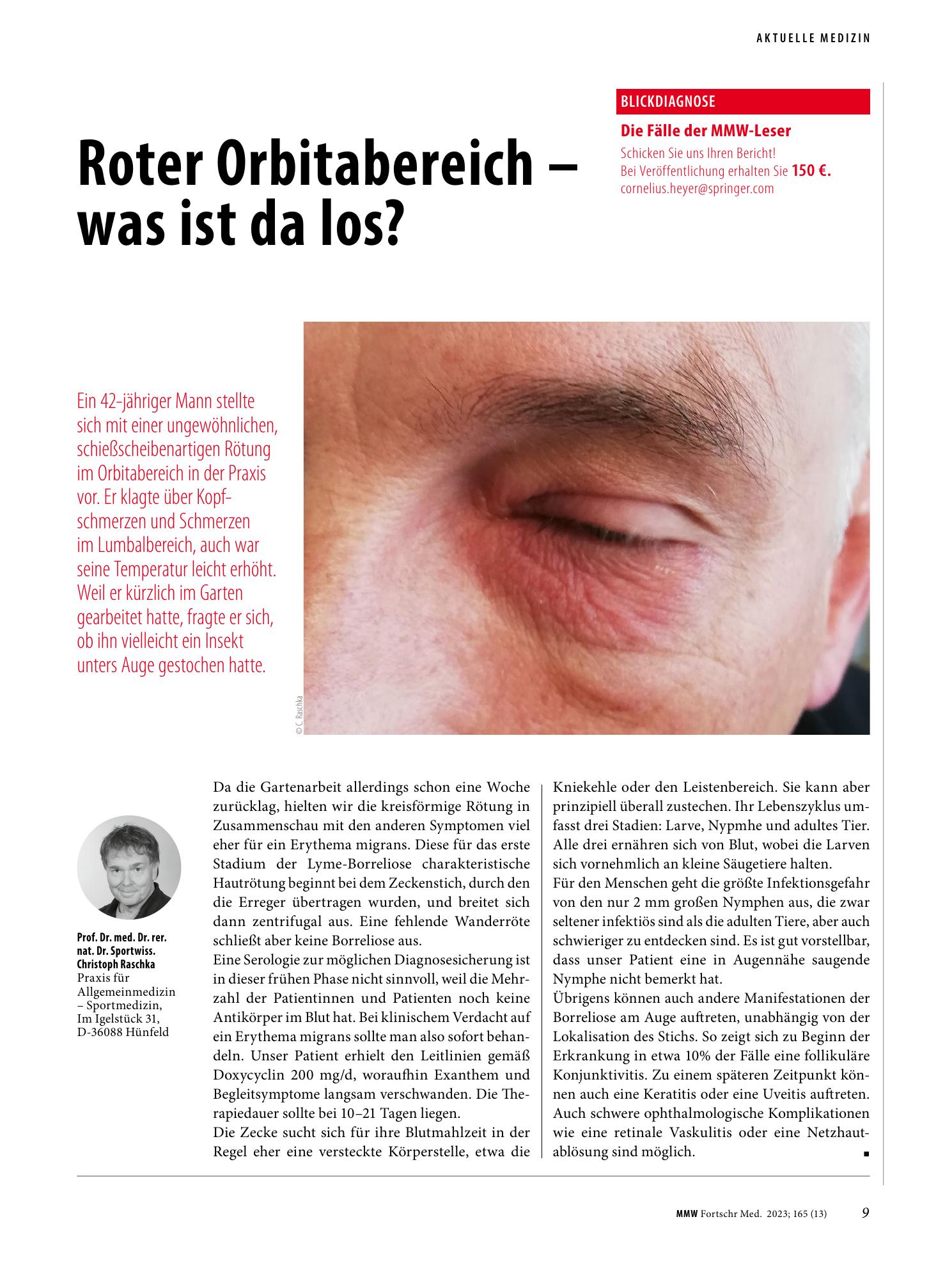 Vorschauseite 1: Roter Orbitabereich - was ist da los?