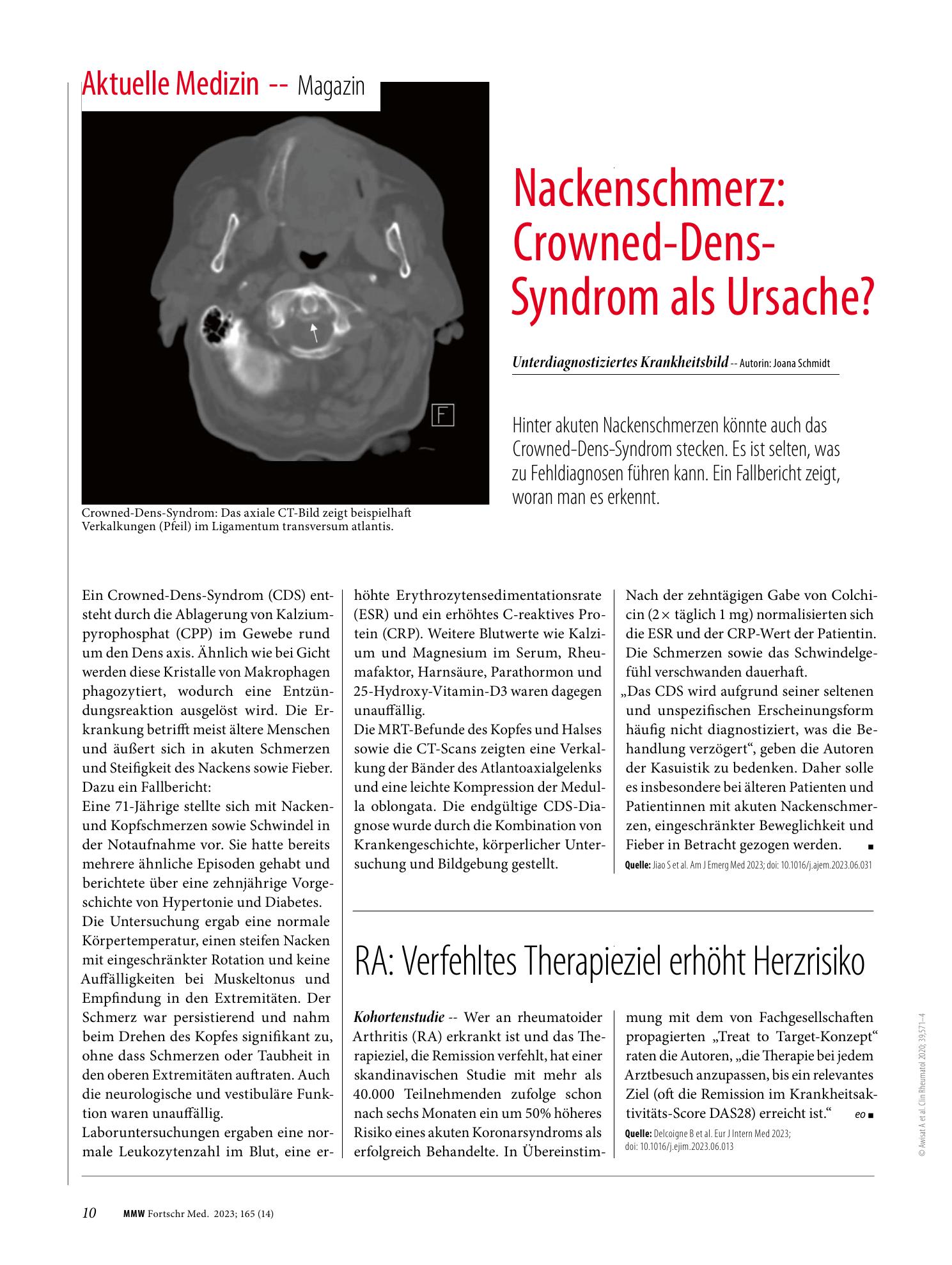 Vorschauseite 1: RA: Verfehltes Therapieziel erhöht Herzrisiko