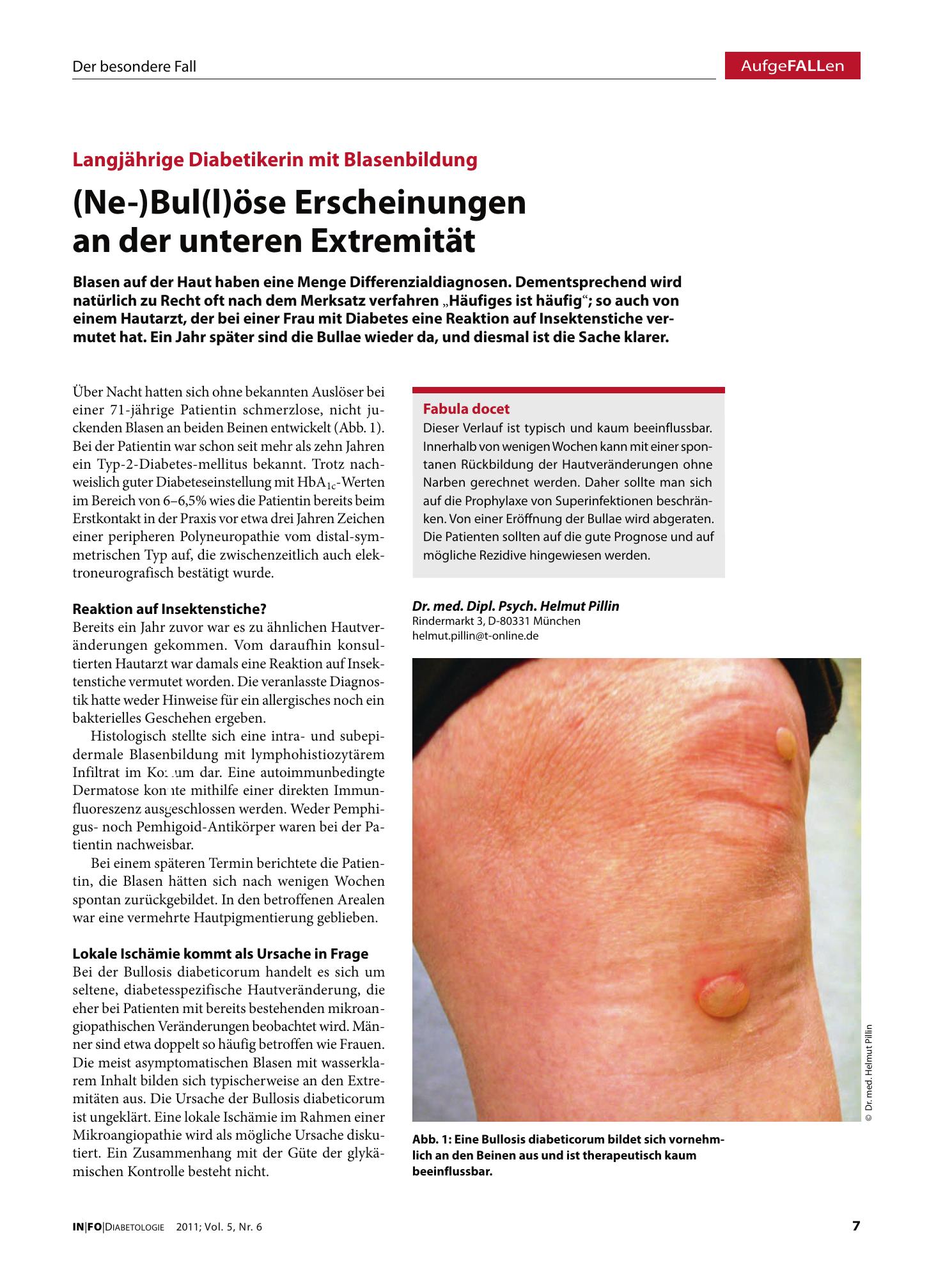 Vorschauseite 1: (Ne-)Bul(l)öse Erscheinungen an der unteren Extremität
