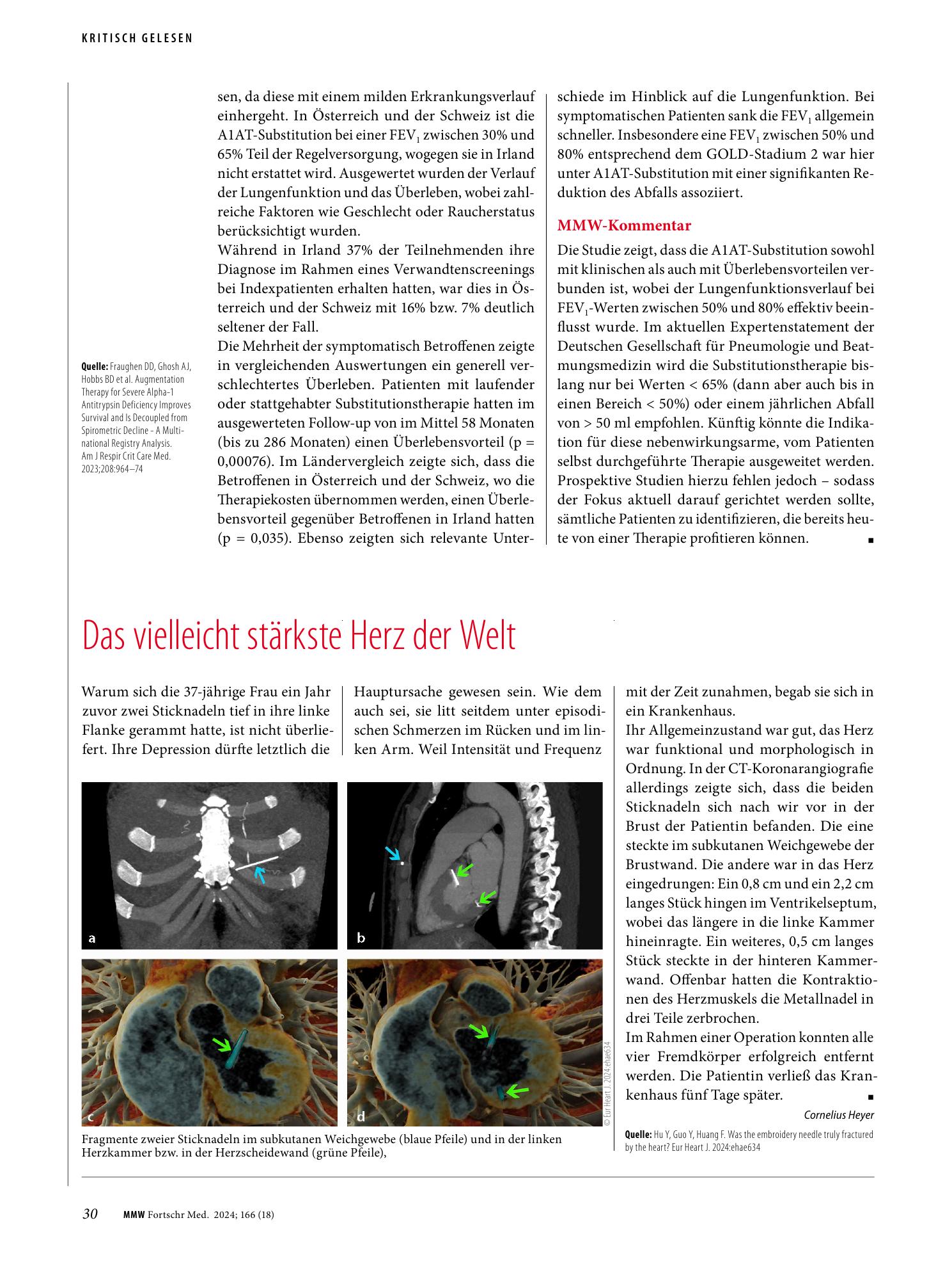 Vorschauseite 1: Das vielleicht stärkste Herz der Welt