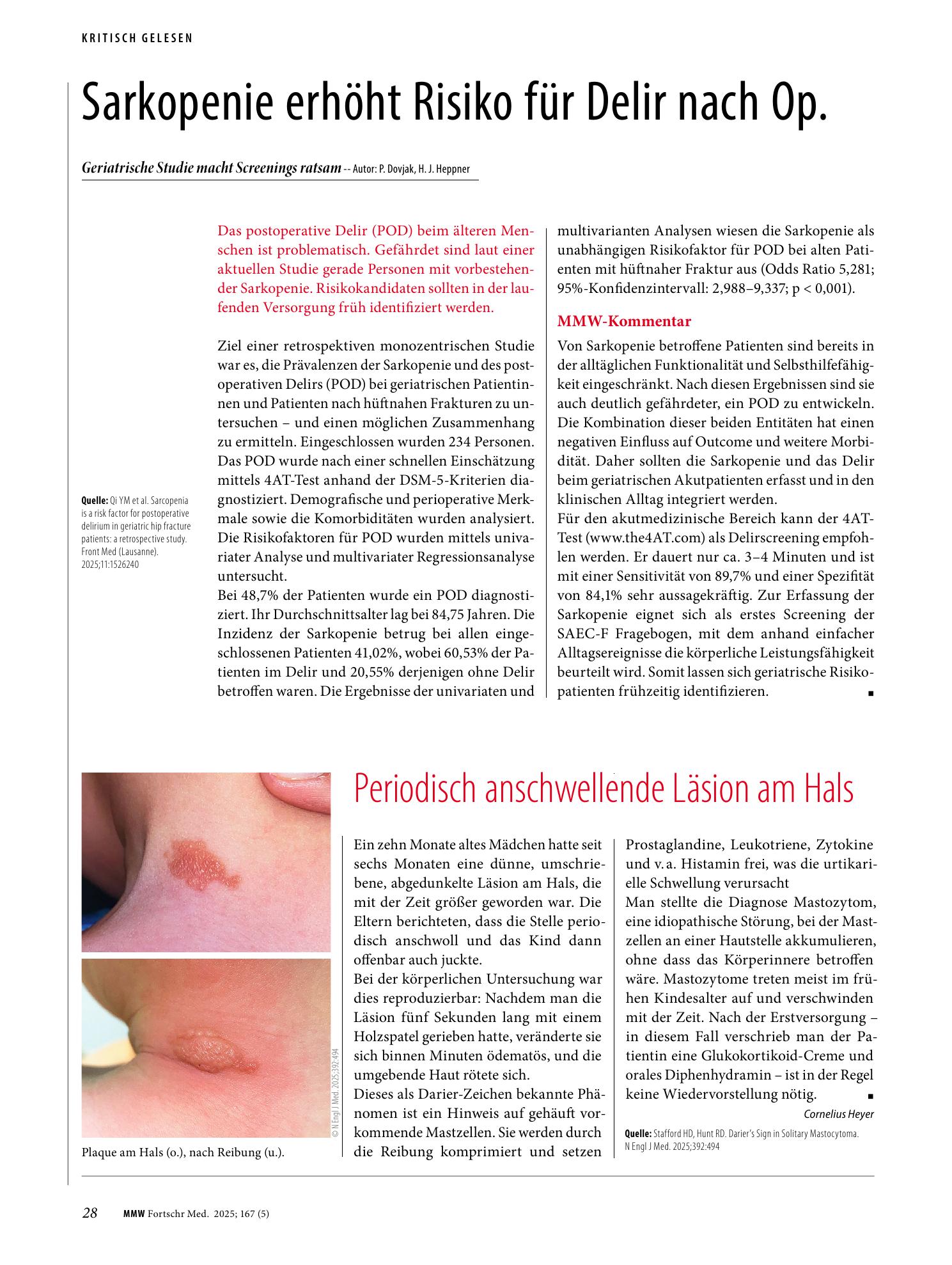 Vorschauseite 1: Sarkopenie erhöht Risiko für Delir nach Op.