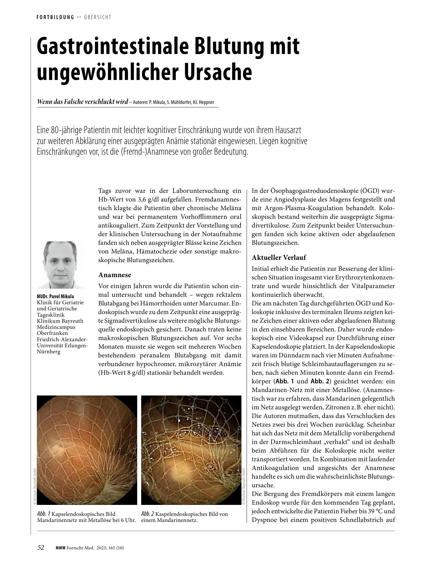 Vorschauseite 1: Gastrointestinale Blutung mit ungewöhnlicher Ursache