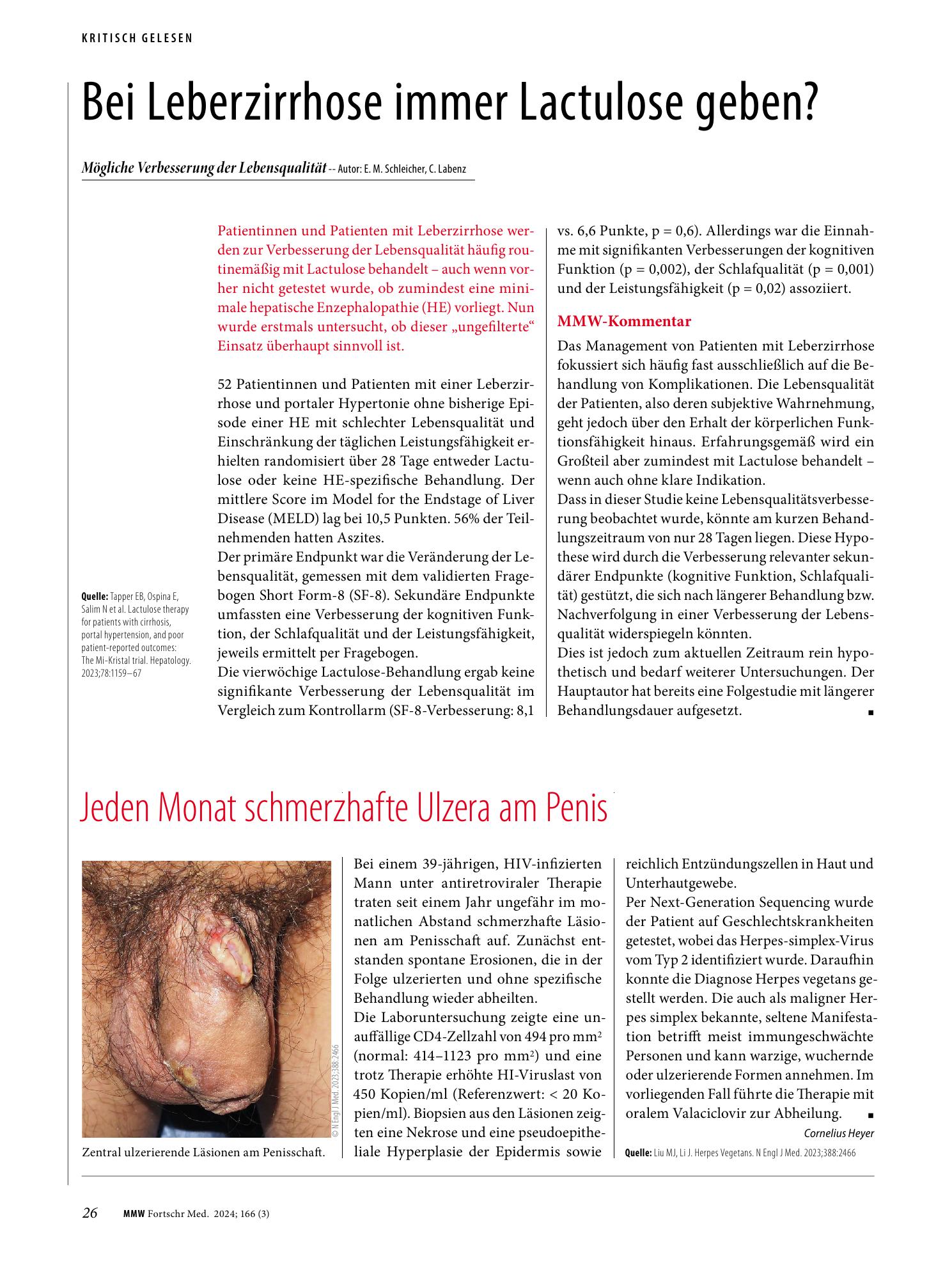 Vorschauseite 1: Bei Leberzirrhose immer Lactulose geben?