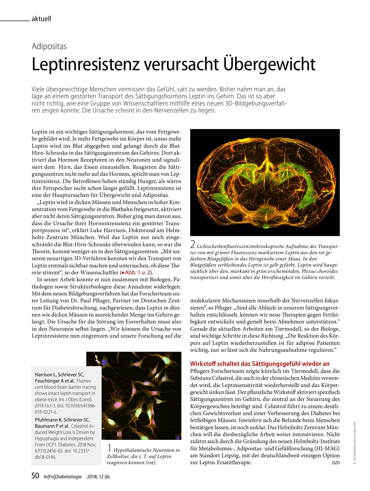 Vorschauseite 1: Leptinresistenz verursacht Übergewicht