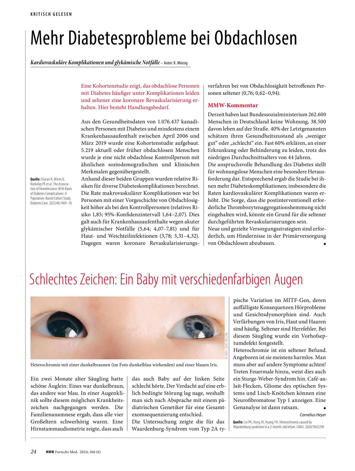 Vorschauseite 1: Schlechtes Zeichen: Ein Baby mit verschiedenfarbigen Augen