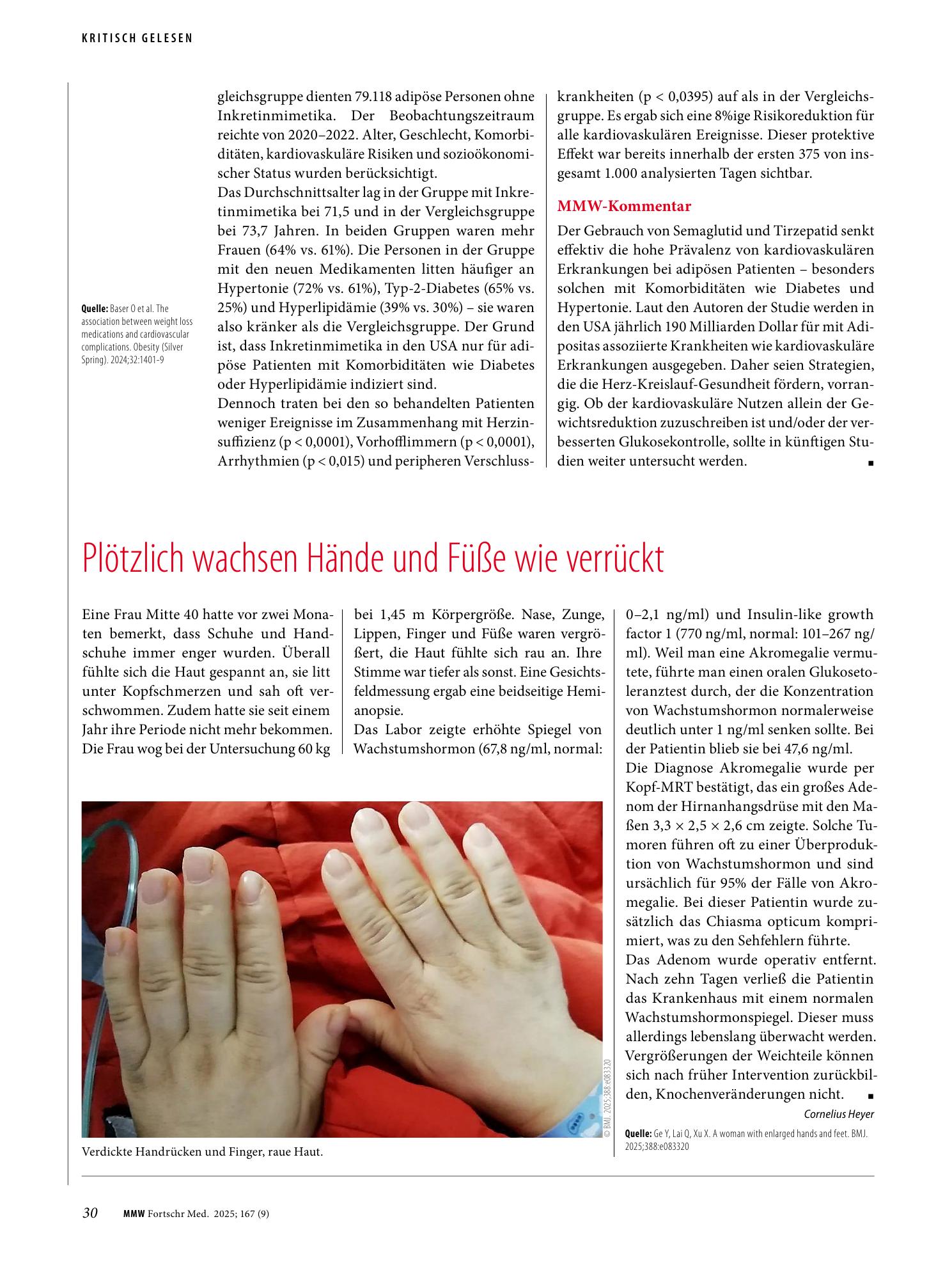 Vorschauseite 1: Plötzlich wachsen Hände und Füße wie verrückt