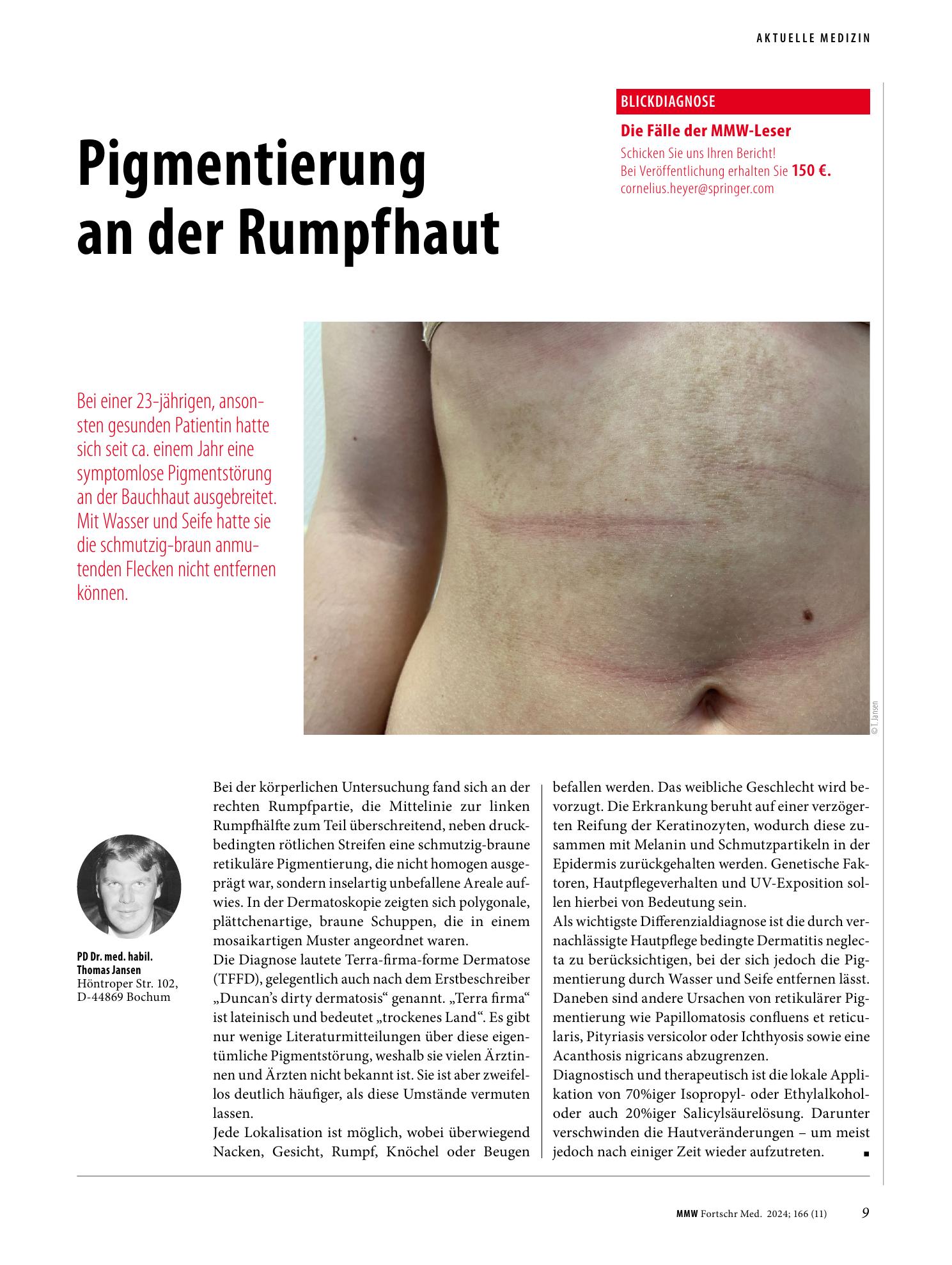 Vorschauseite 1: Pigmentierung an der Rumpfhaut