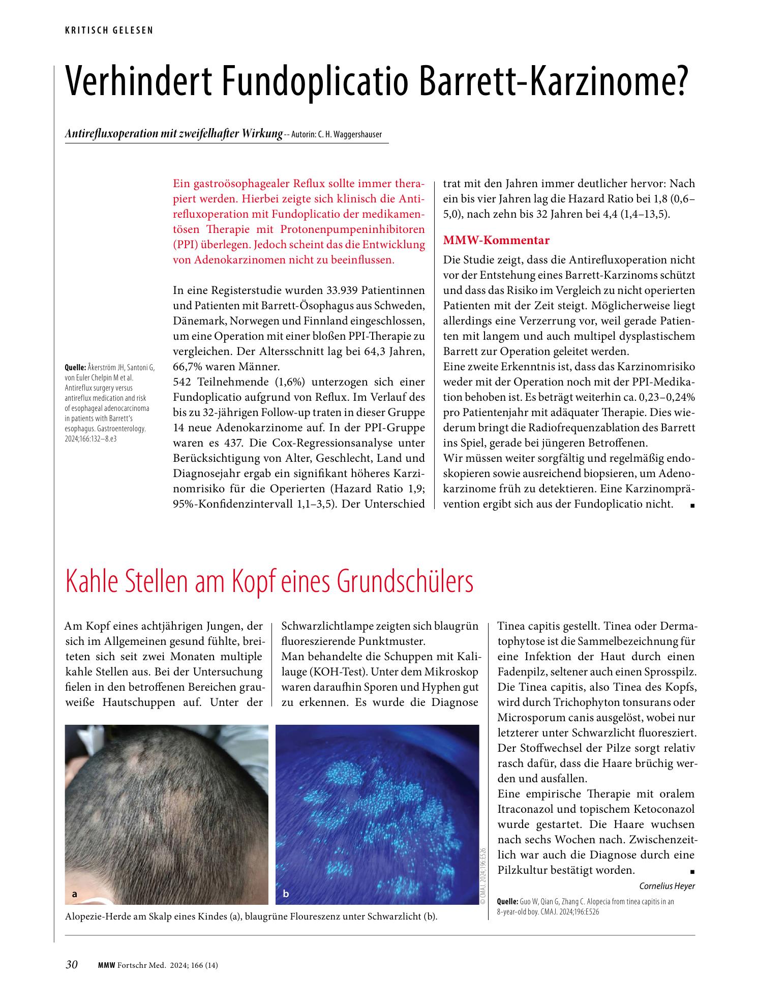 Vorschauseite 1: Verhindert Fundoplicatio Barrett-Karzinome?