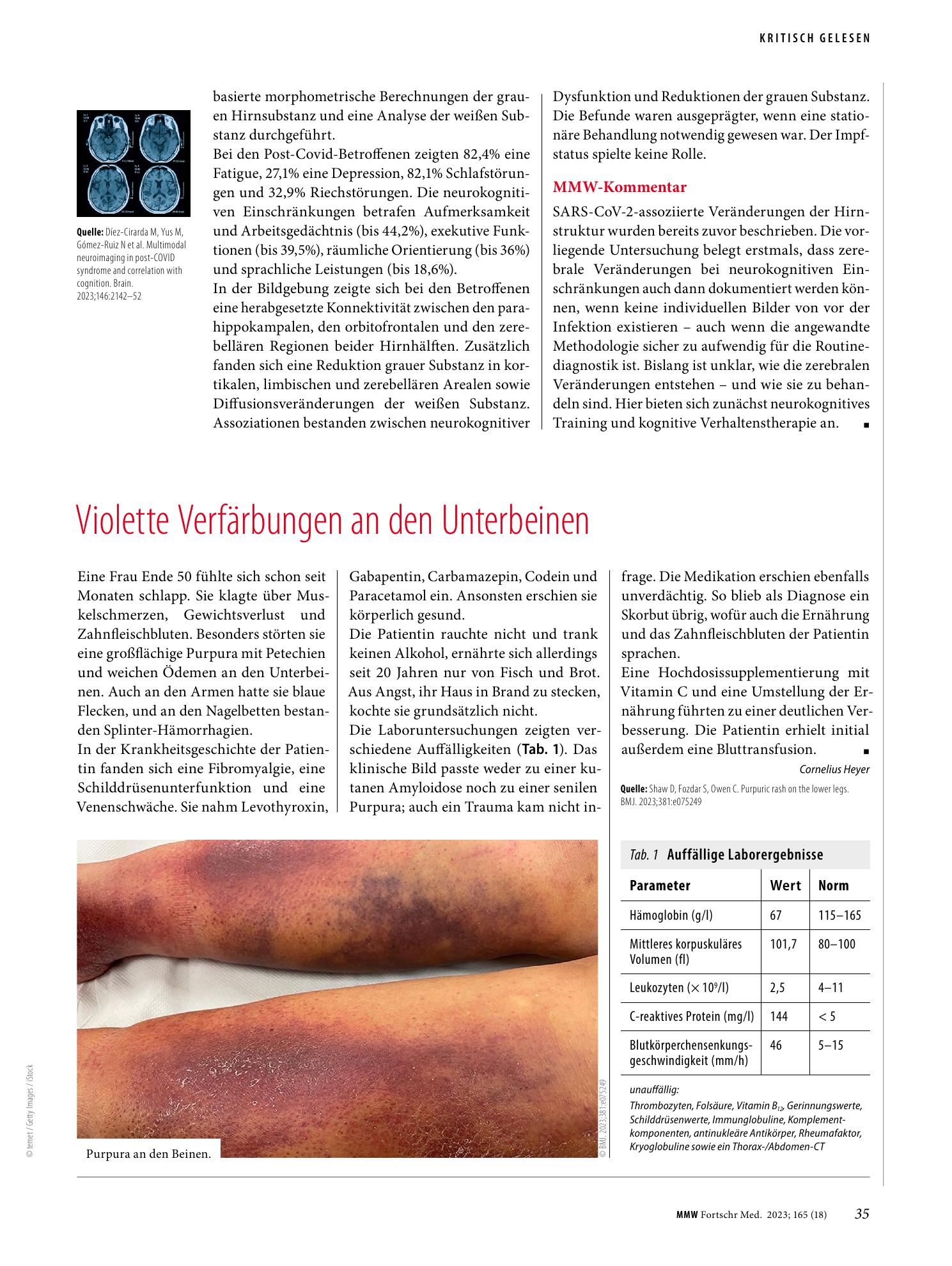 Vorschauseite 1: Violette Verfärbungen an den Unterbeinen