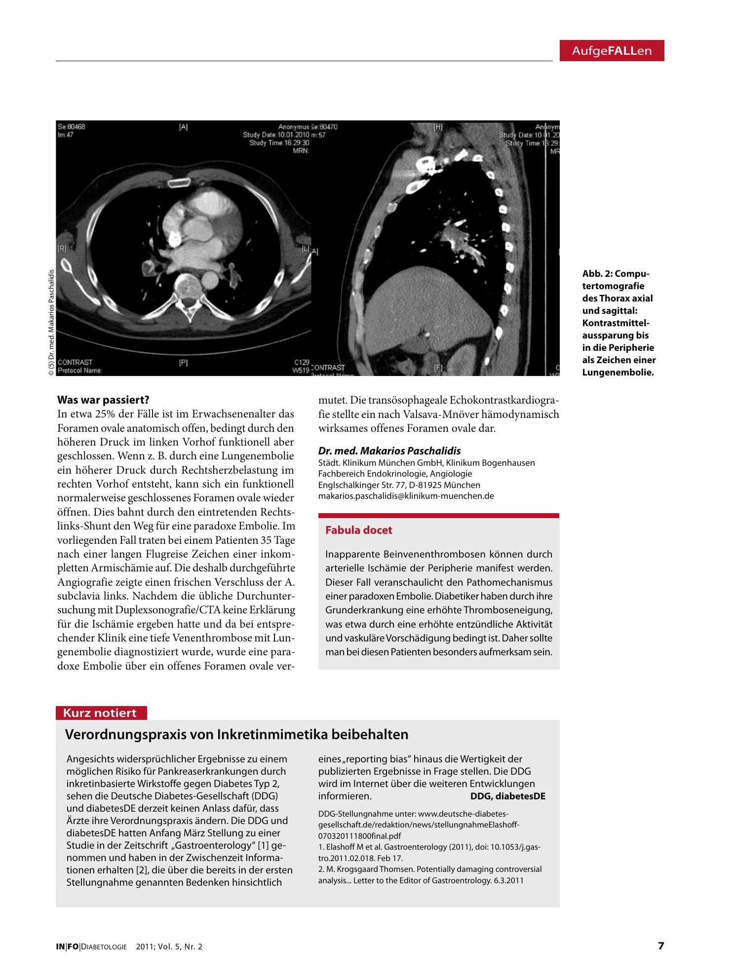 Vorschauseite 1: Verordnungspraxis von Inkretinmimetika beibehalten