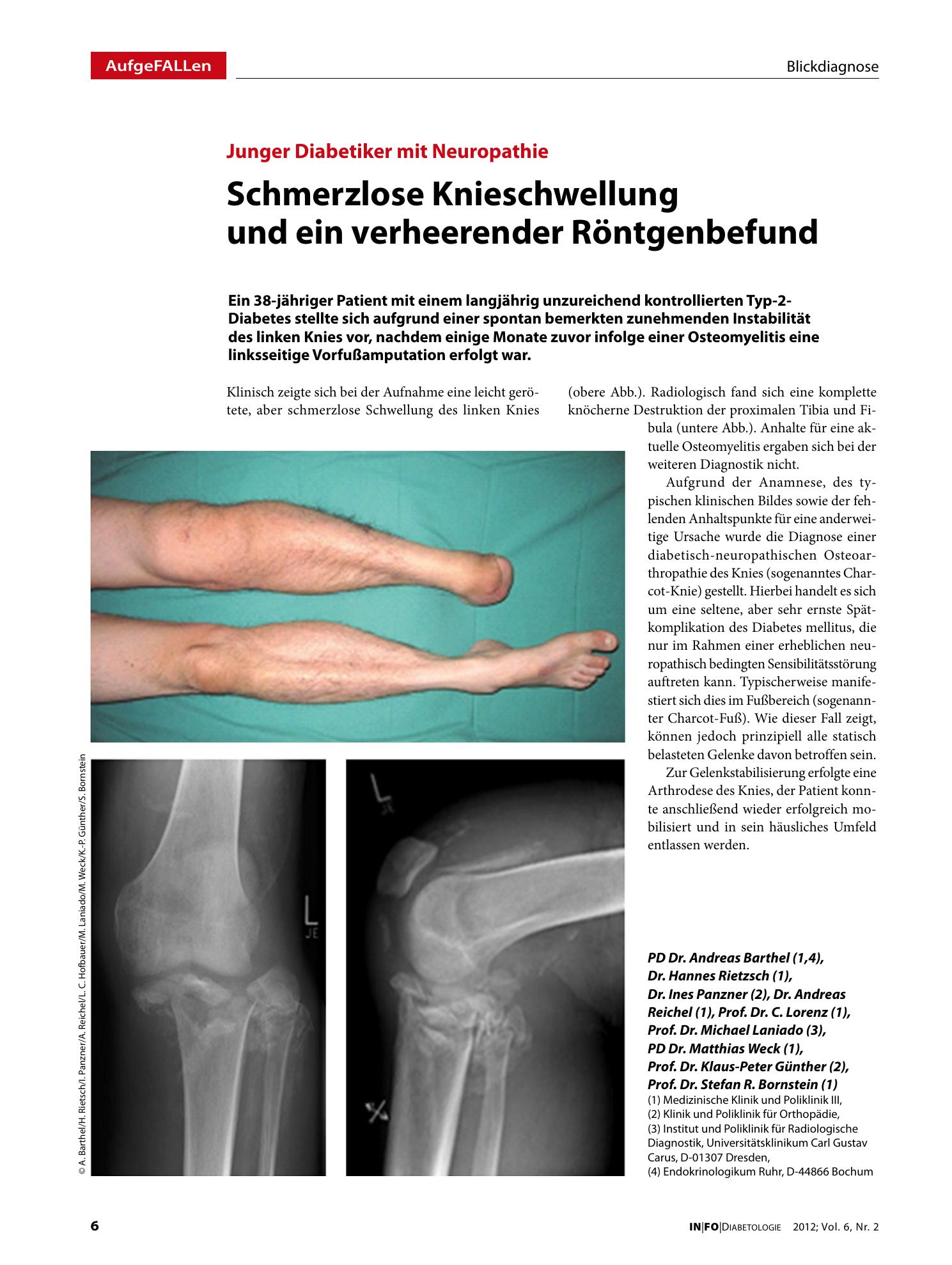 Vorschauseite 1: Schmerzlose Knieschwellung und ein verheerender Röntgenbefund