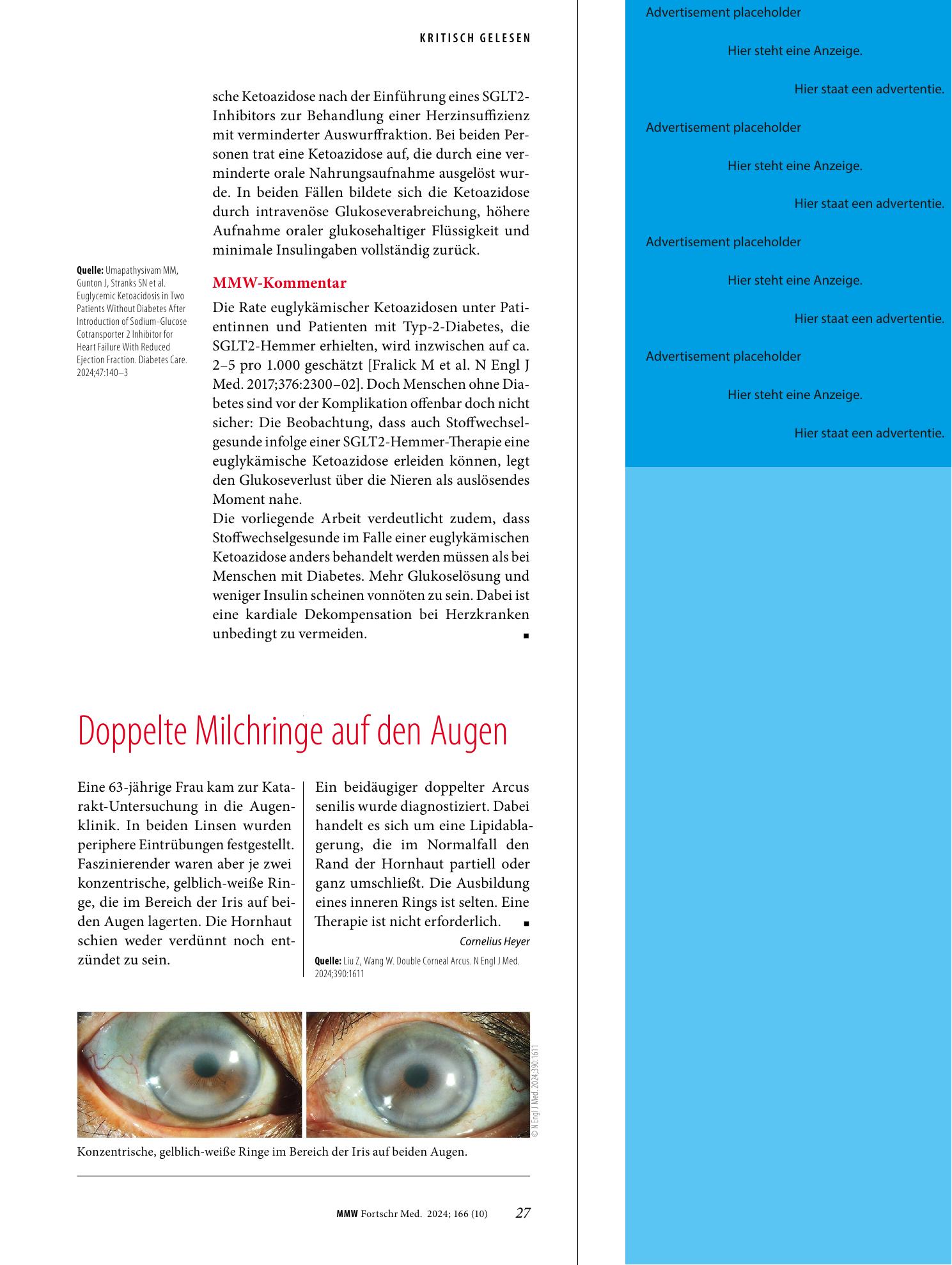 Vorschauseite 1: Doppelte Milchringe auf den Augen