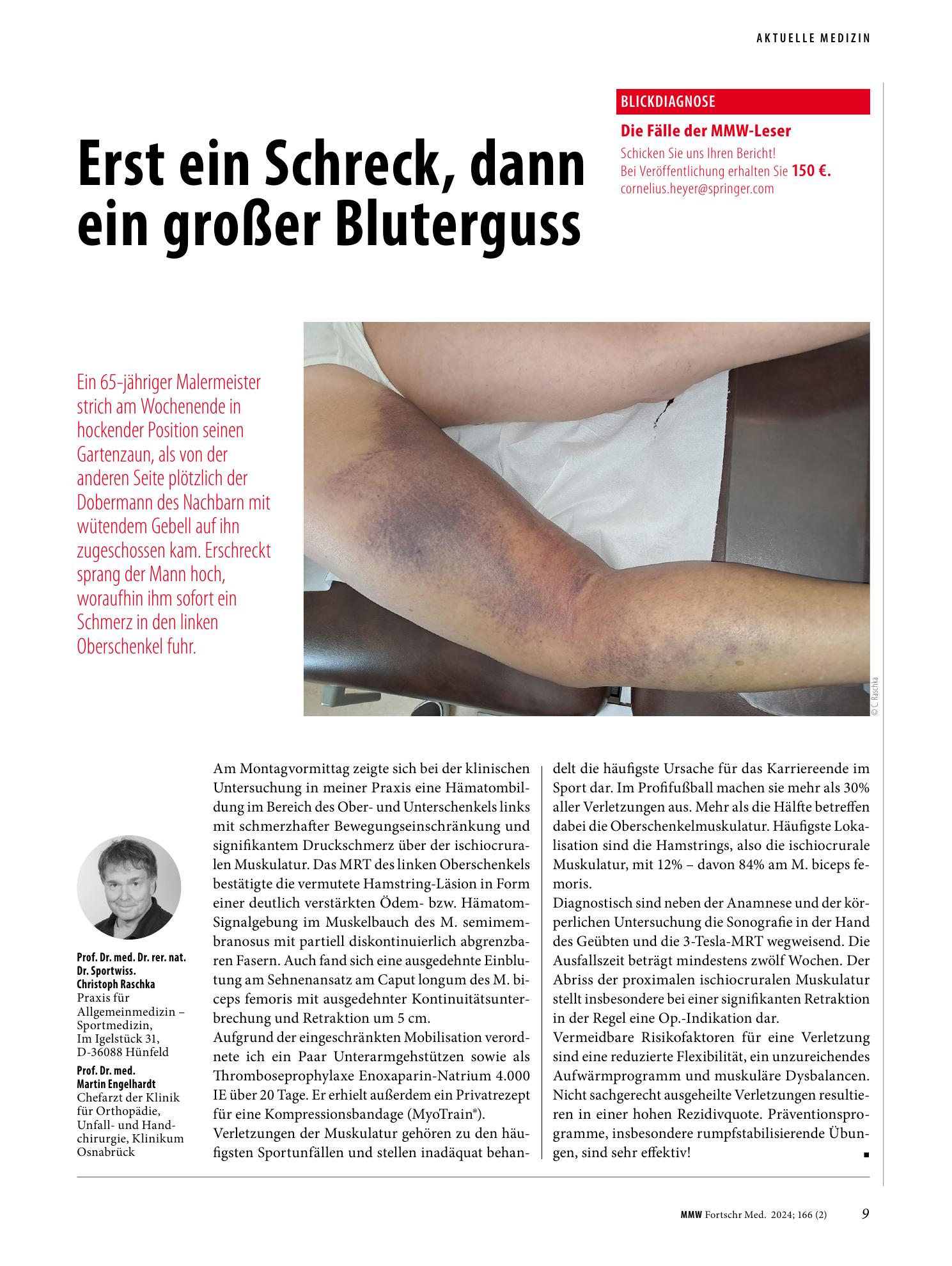 Vorschauseite 1: Erst ein Schreck, dann ein großer Bluterguss