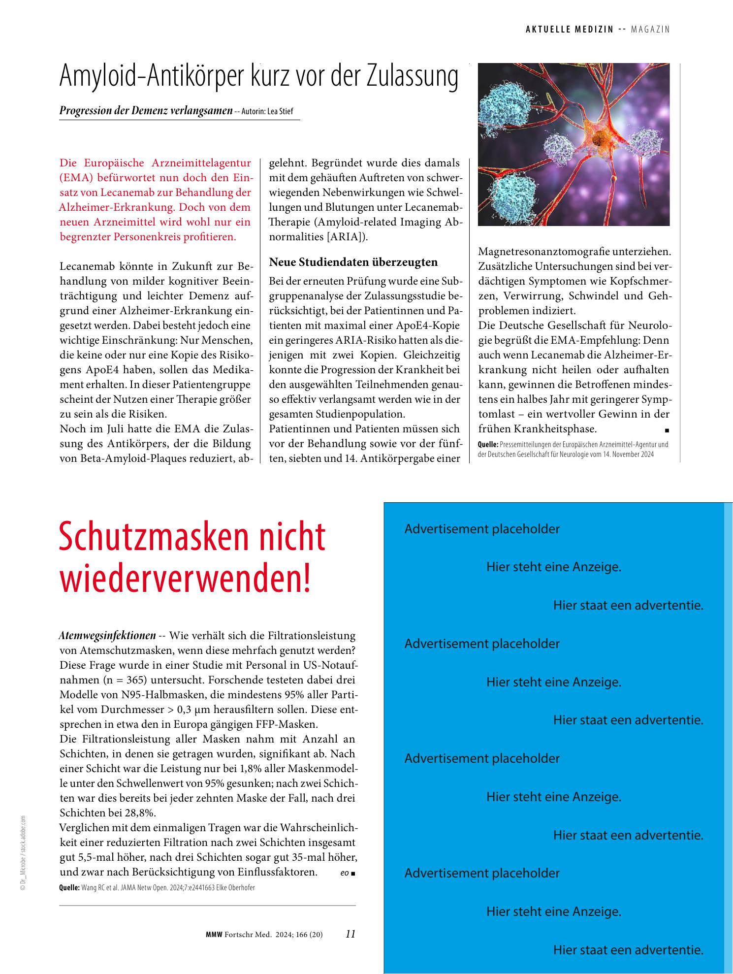 Vorschauseite 1: Amyloid-Antikörper kurz vor der Zulassung