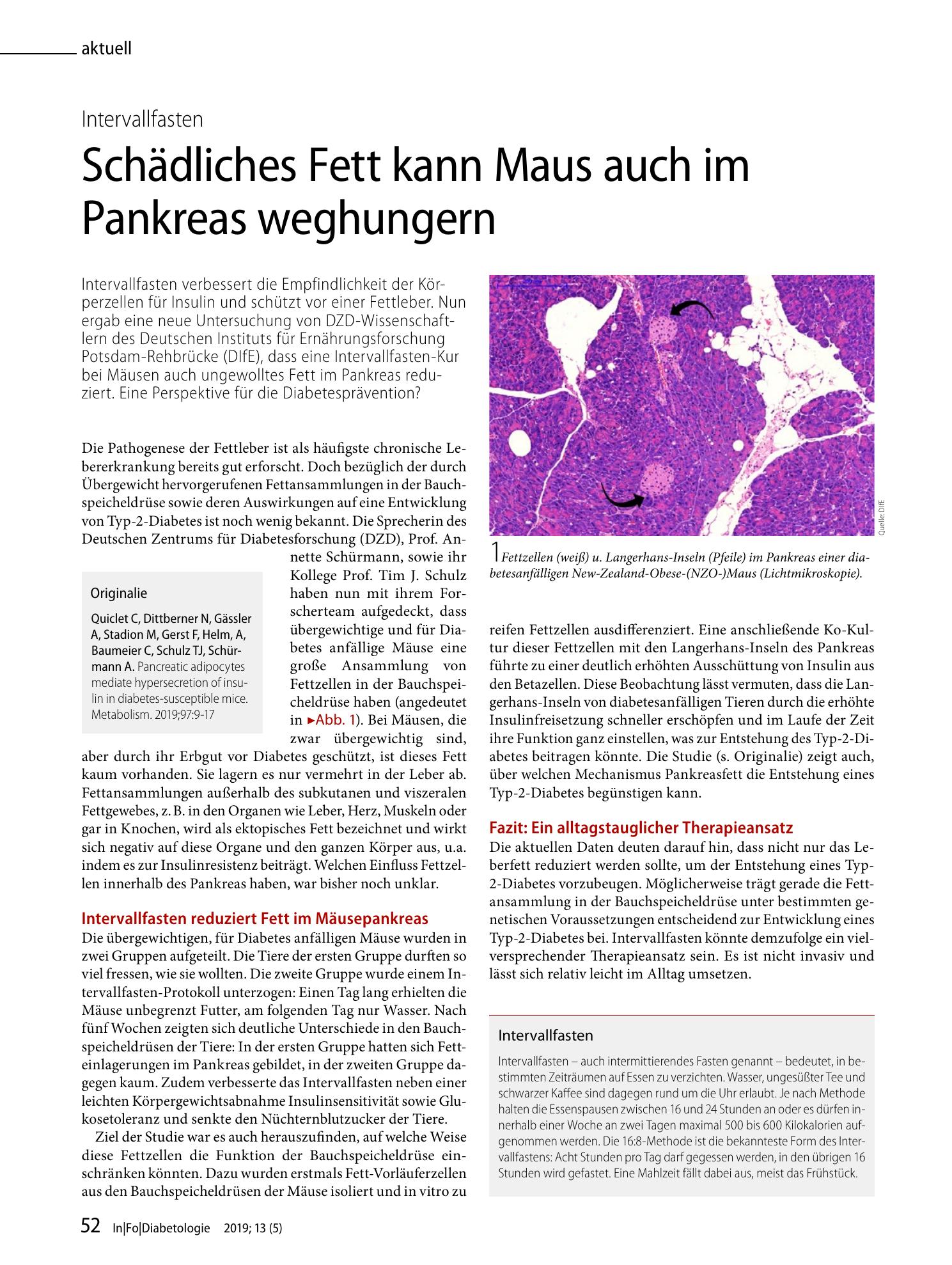 Vorschauseite 1: Schädliches Fett kann Maus auch im Pankreas weghungern