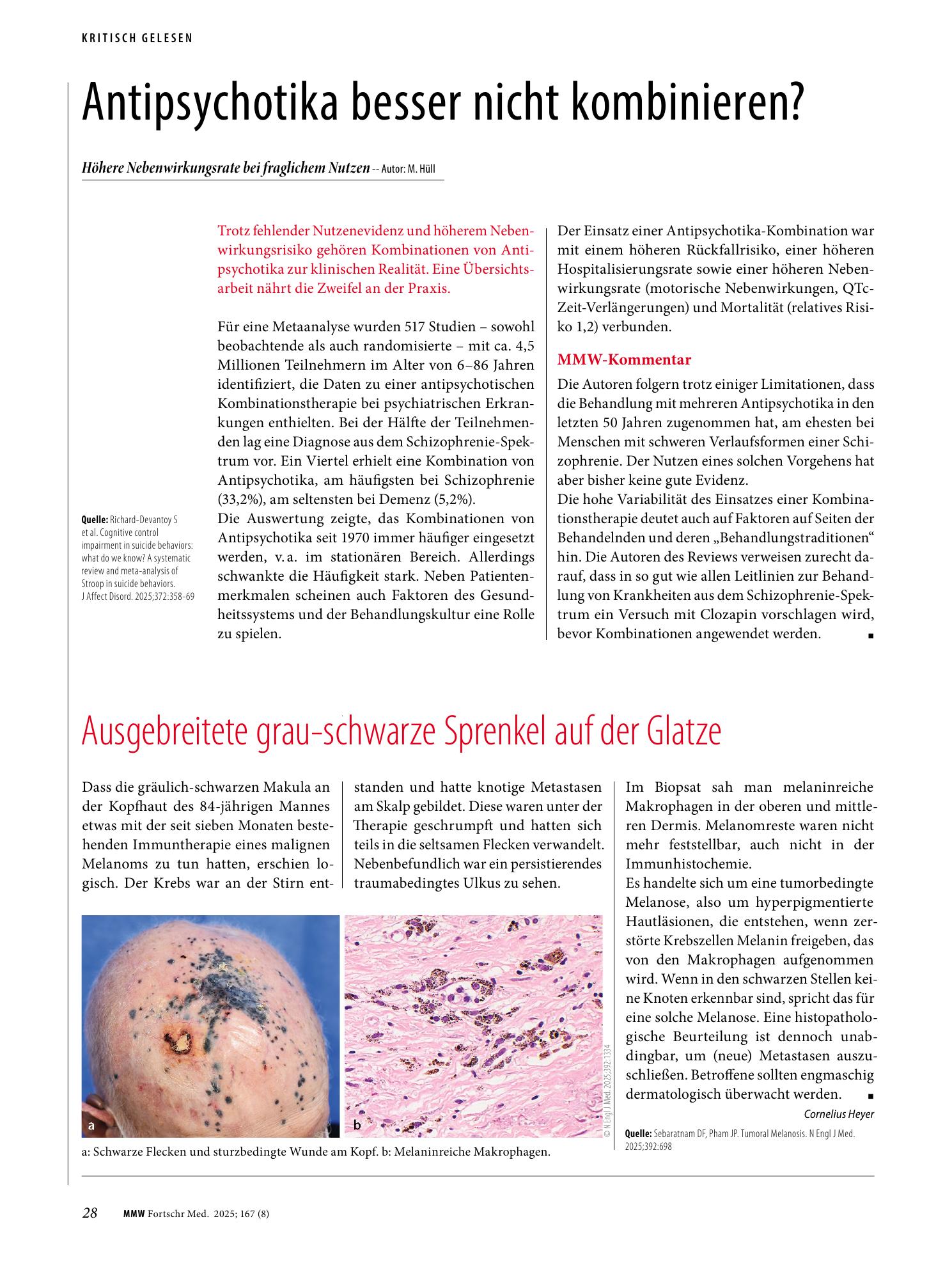 Vorschauseite 1: Antipsychotika besser nicht kombinieren?