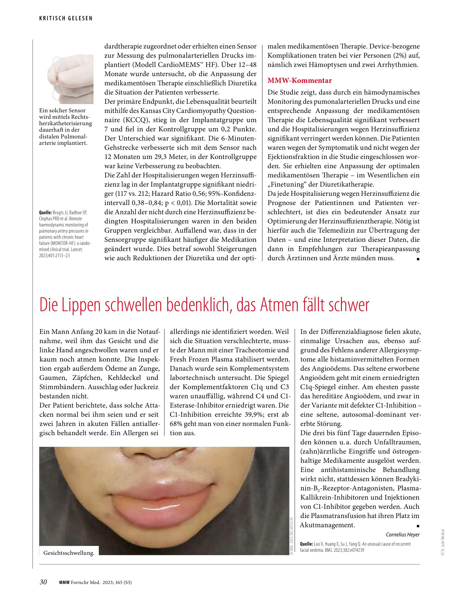 Vorschauseite 1: Die Lippen schwellen bedenklich, das Atmen fällt schwer
