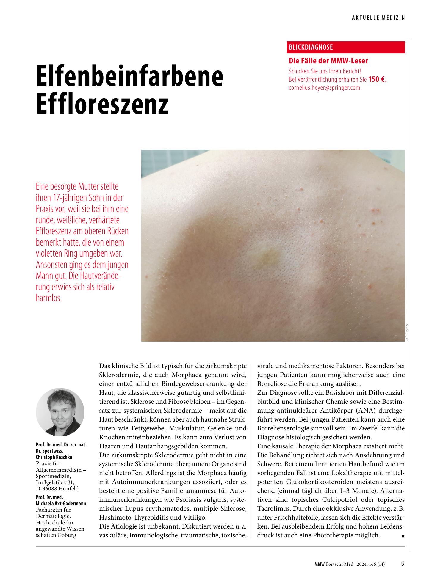 Vorschauseite 1: Elfenbeinfarbene Effloreszenz