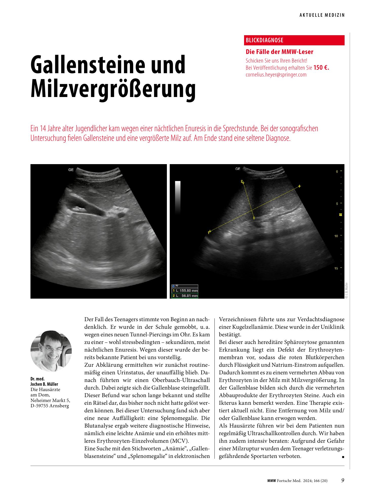 Vorschauseite 1: Gallensteine und Milzvergrößerung