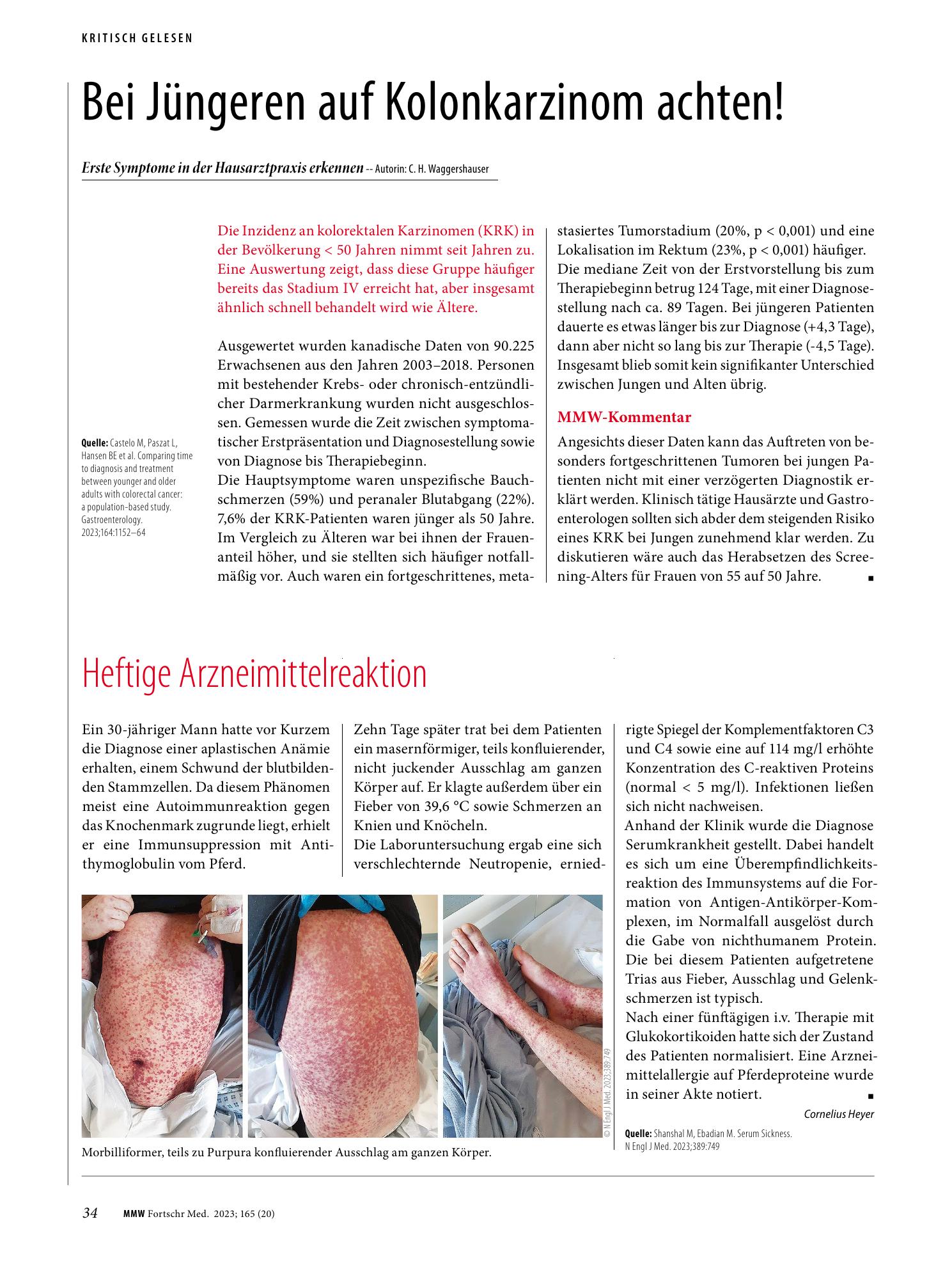 Vorschauseite 1: Bei Jüngeren auf Kolonkarzinom achten!