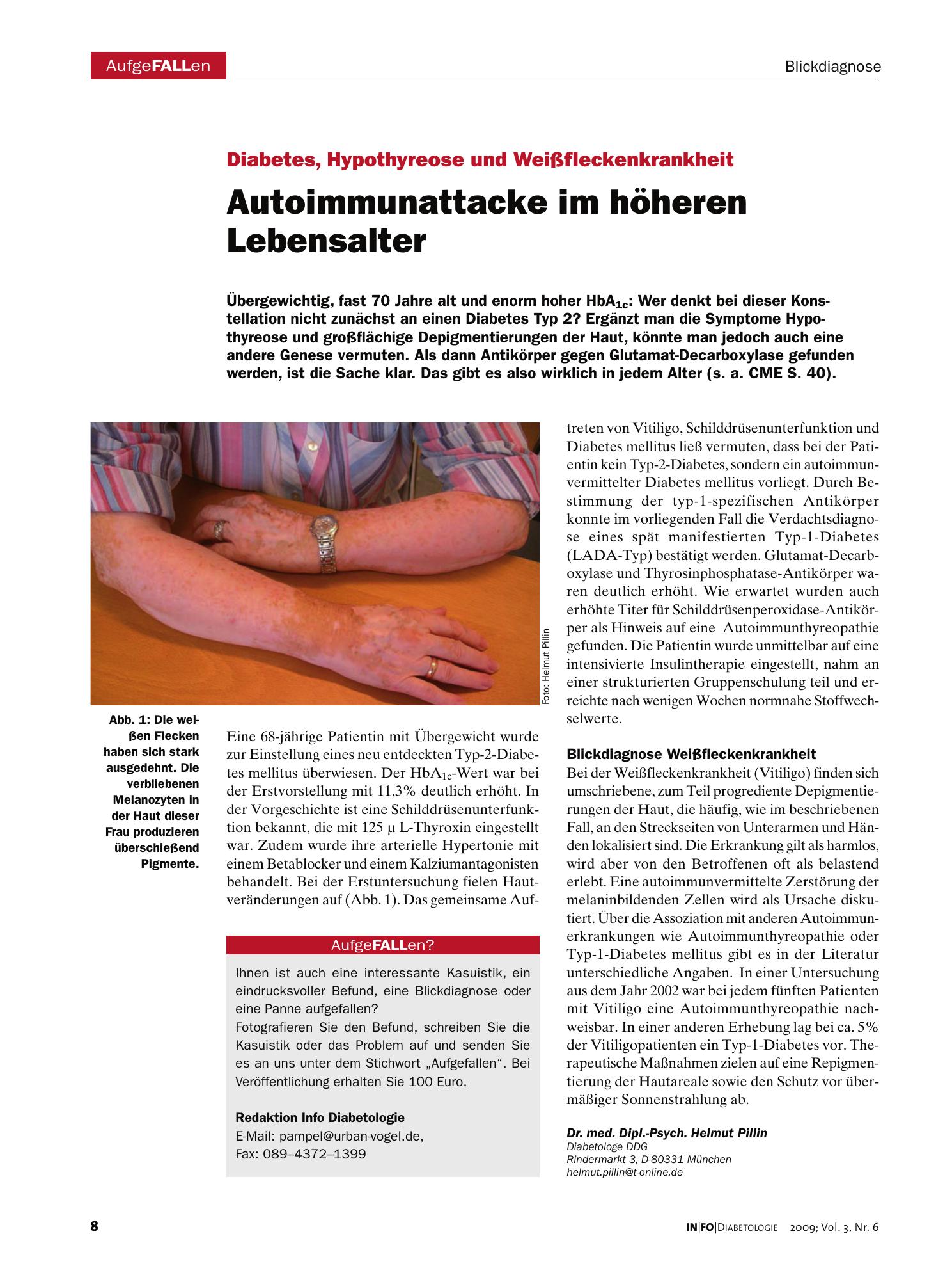 Vorschauseite 1: Autoimmunattacke im höheren Lebensalter