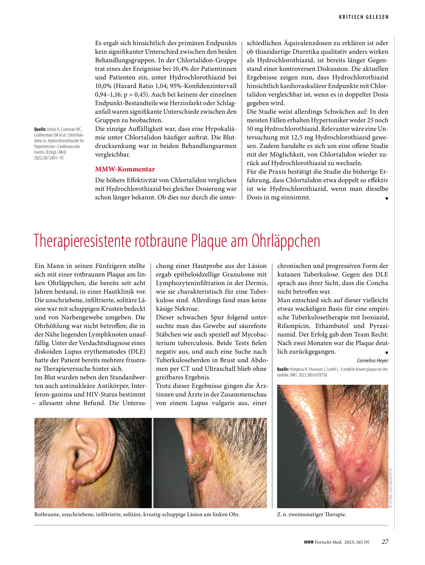 Vorschauseite 1: Therapieresistente rotbraune Plaque am Ohrläppchen