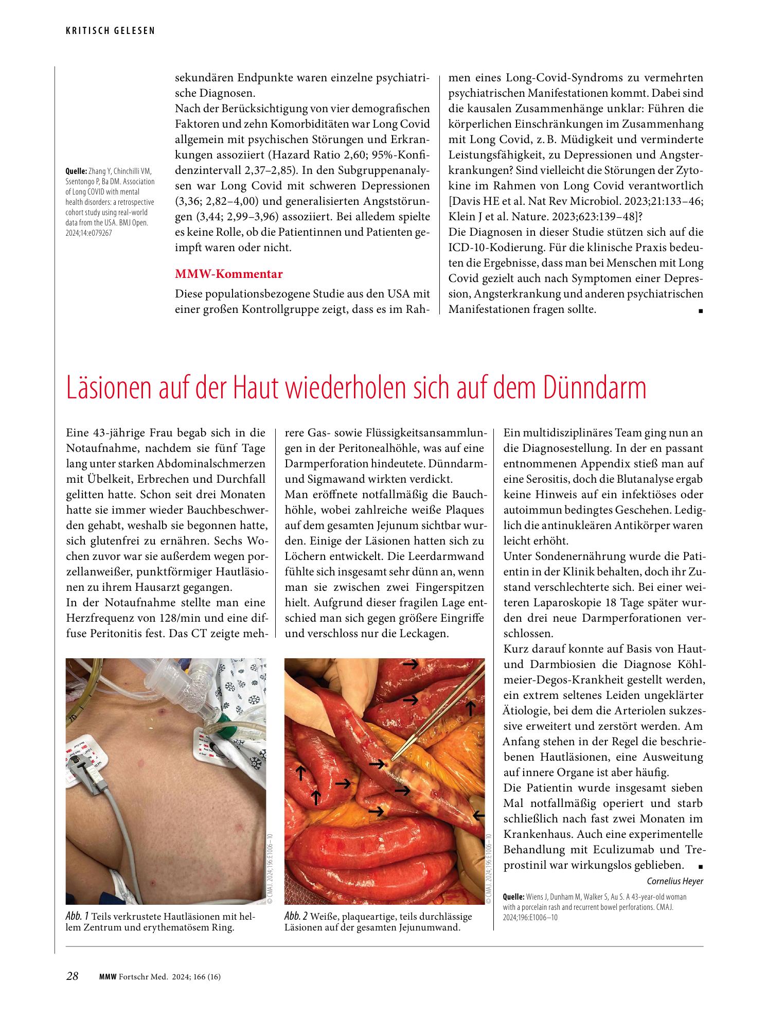 Vorschauseite 1: Läsionen auf der Haut wiederholen sich auf dem Dünndarm