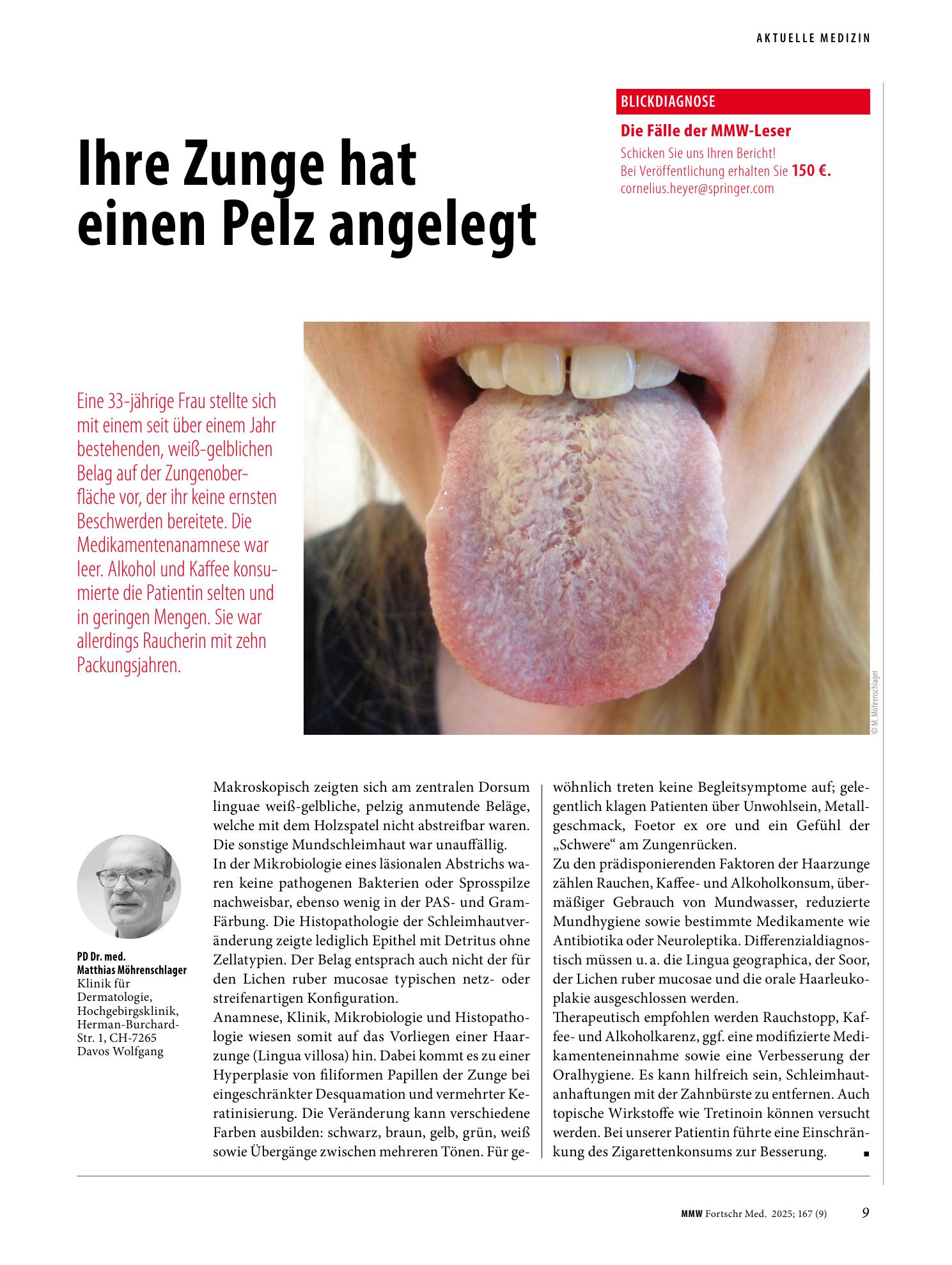 Vorschauseite 1: Ihre Zunge hat einen Pelz angelegt