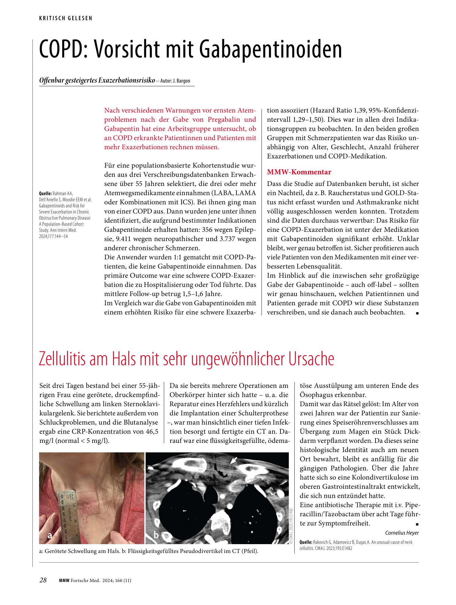 Vorschauseite 1: COPD: Vorsicht mit Gabapentinoiden