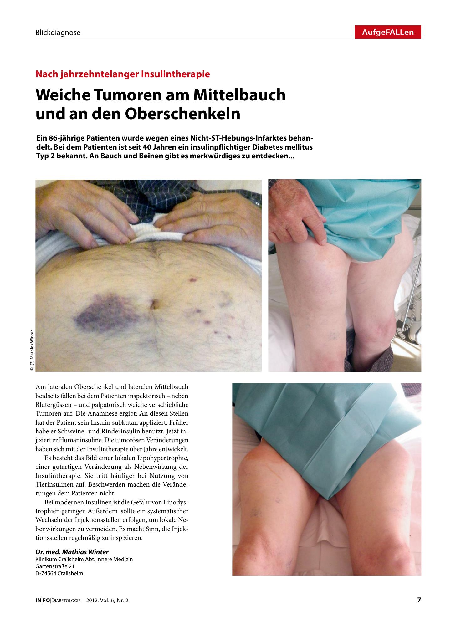 Vorschauseite 1: Weiche Tumoren am Mittelbauch und an den Oberschenkeln