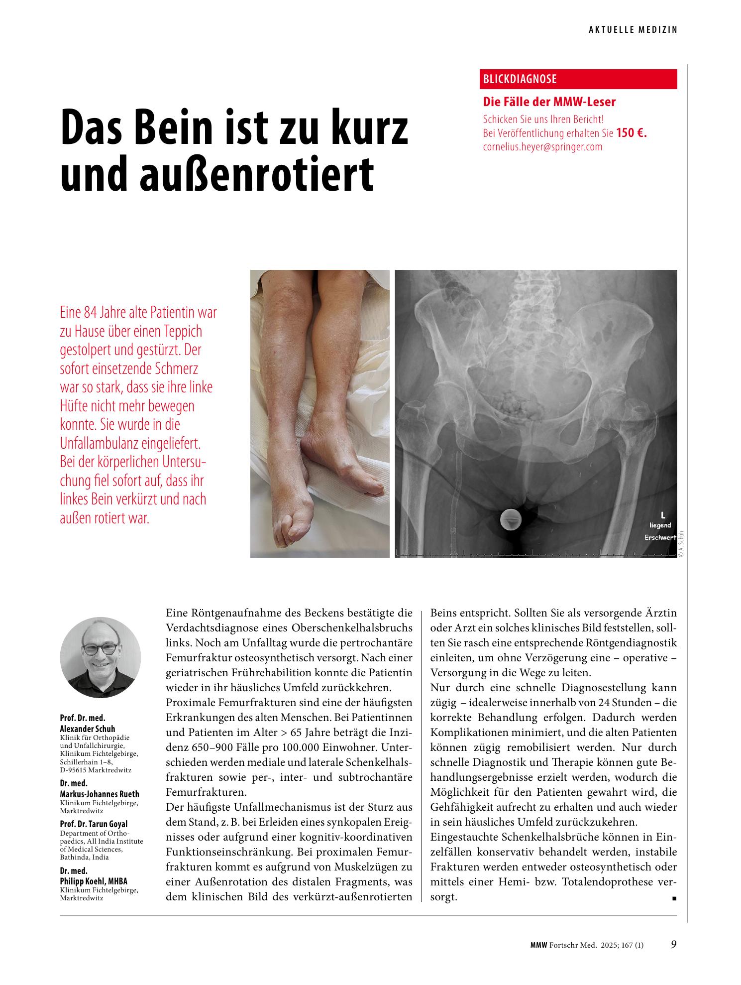 Vorschauseite 1: Proximal femoral fracture