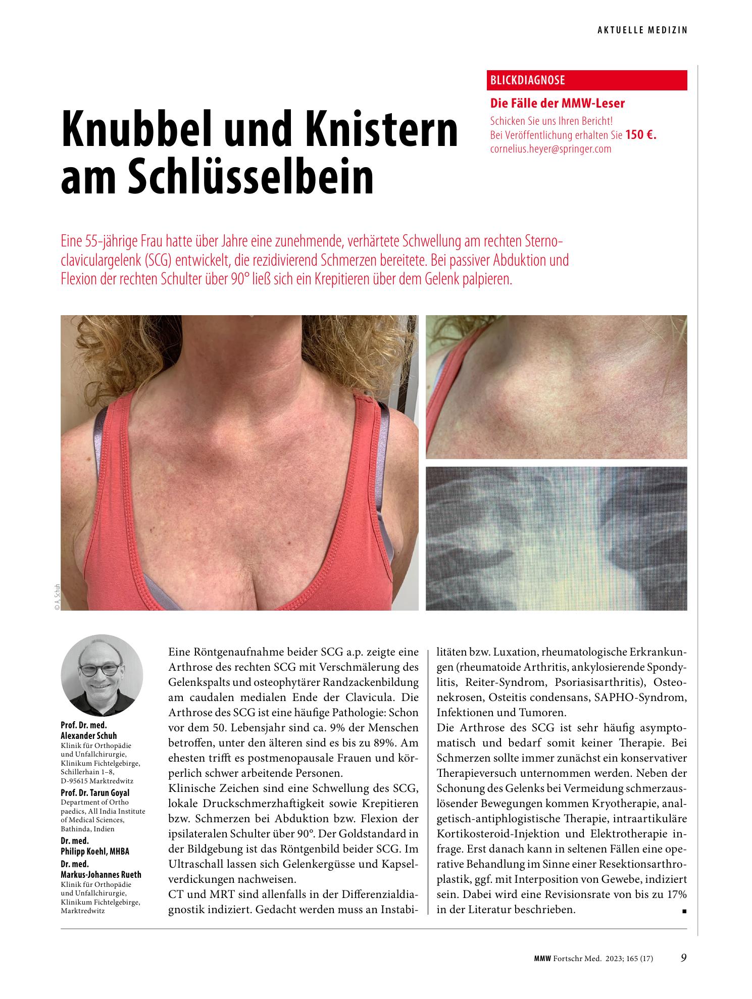 Vorschauseite 1: Knubbel und Knistern am Schlüsselbein
