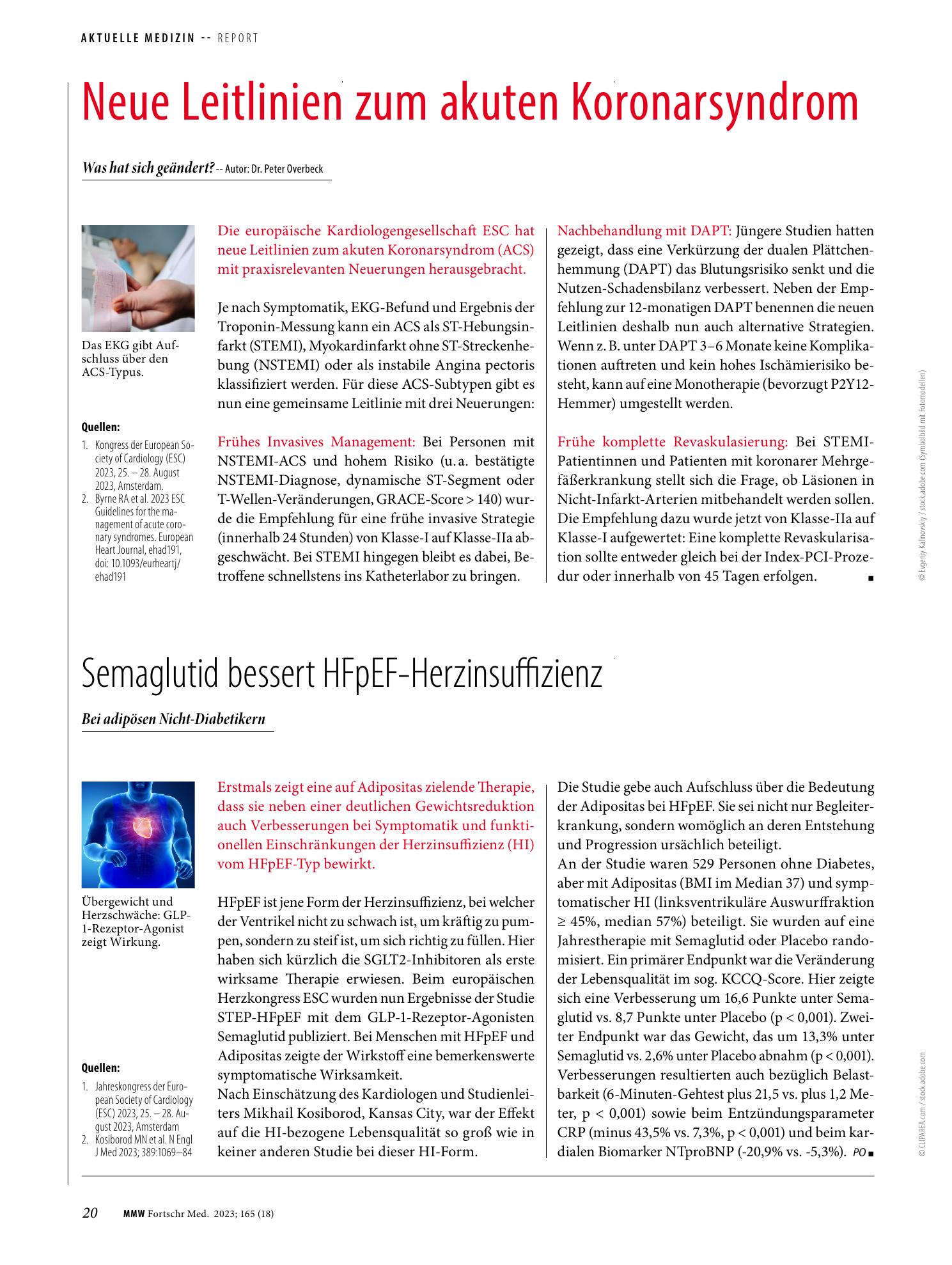 Vorschauseite 1: Neue Leitlinien zum akuten Koronarsyndrom