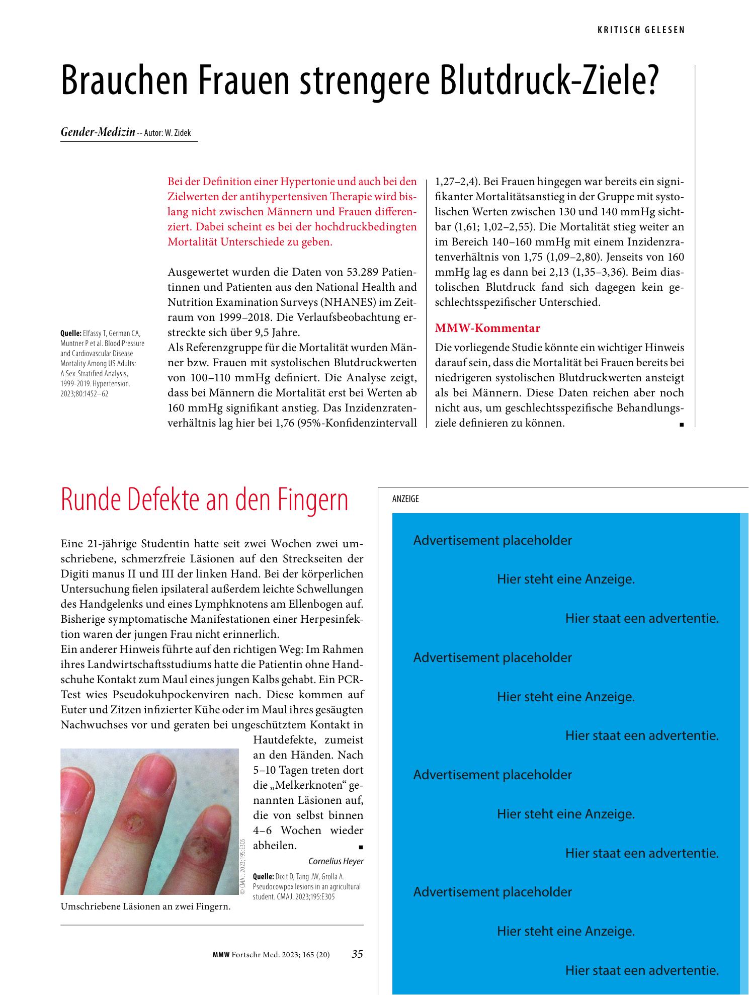 Vorschauseite 1: Brauchen Frauen strengere Blutdruck-Ziele?
